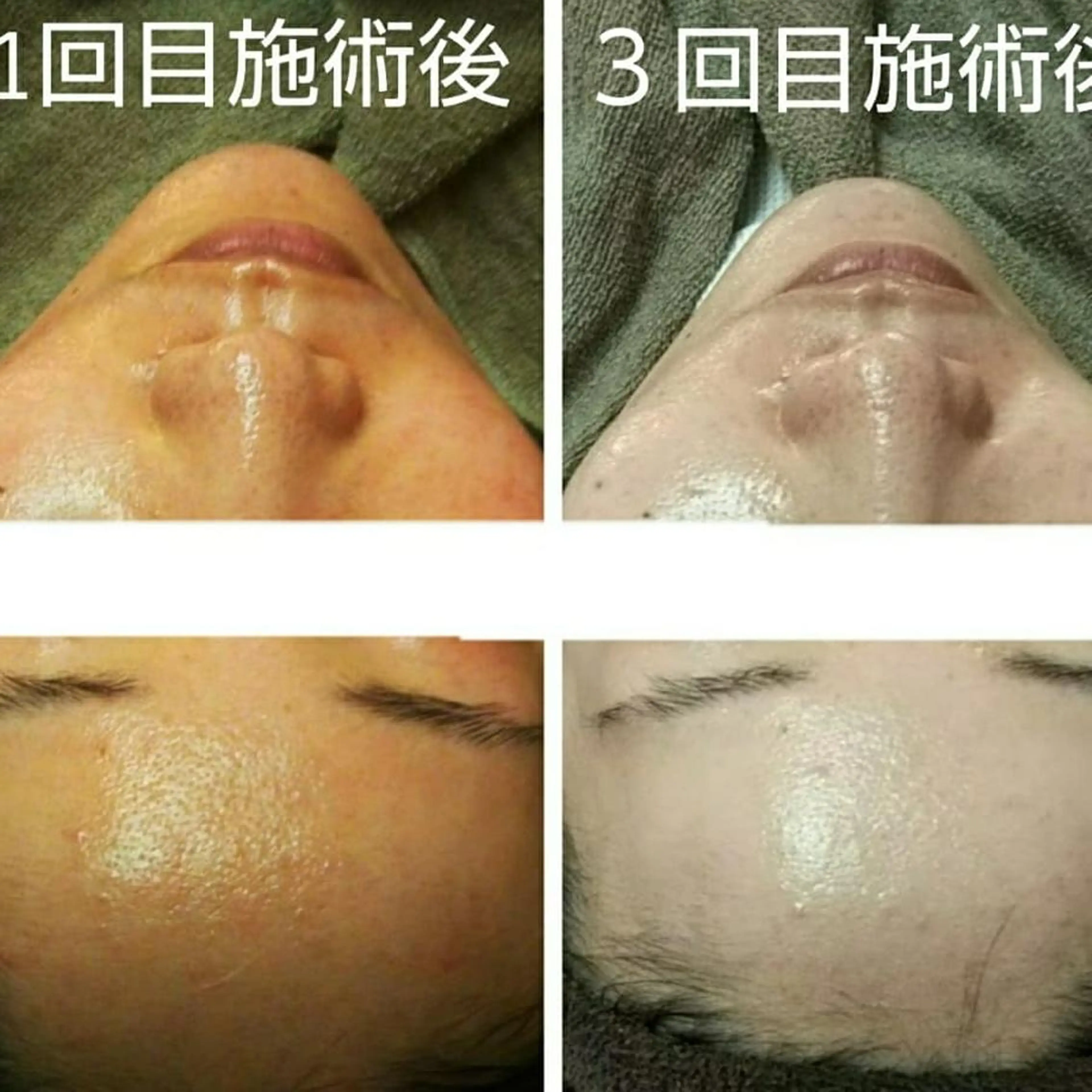 エステ 小顔 美肌専門 Matoriaのエステ・リラクイメージ