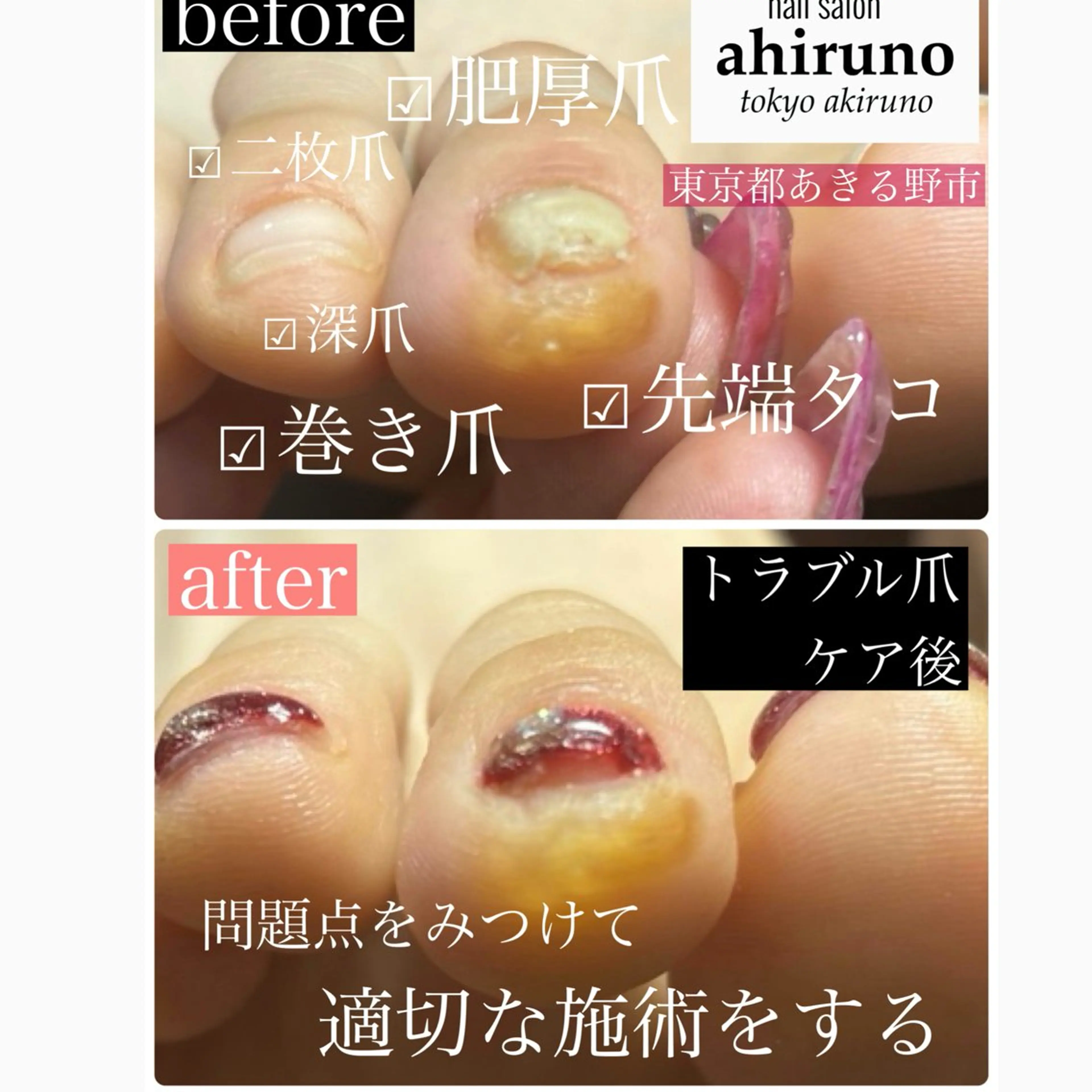 ネイル フットネイル ジェルネイル 東京あきる野市ネイル ✿ ｙｕiのネイルデザイン