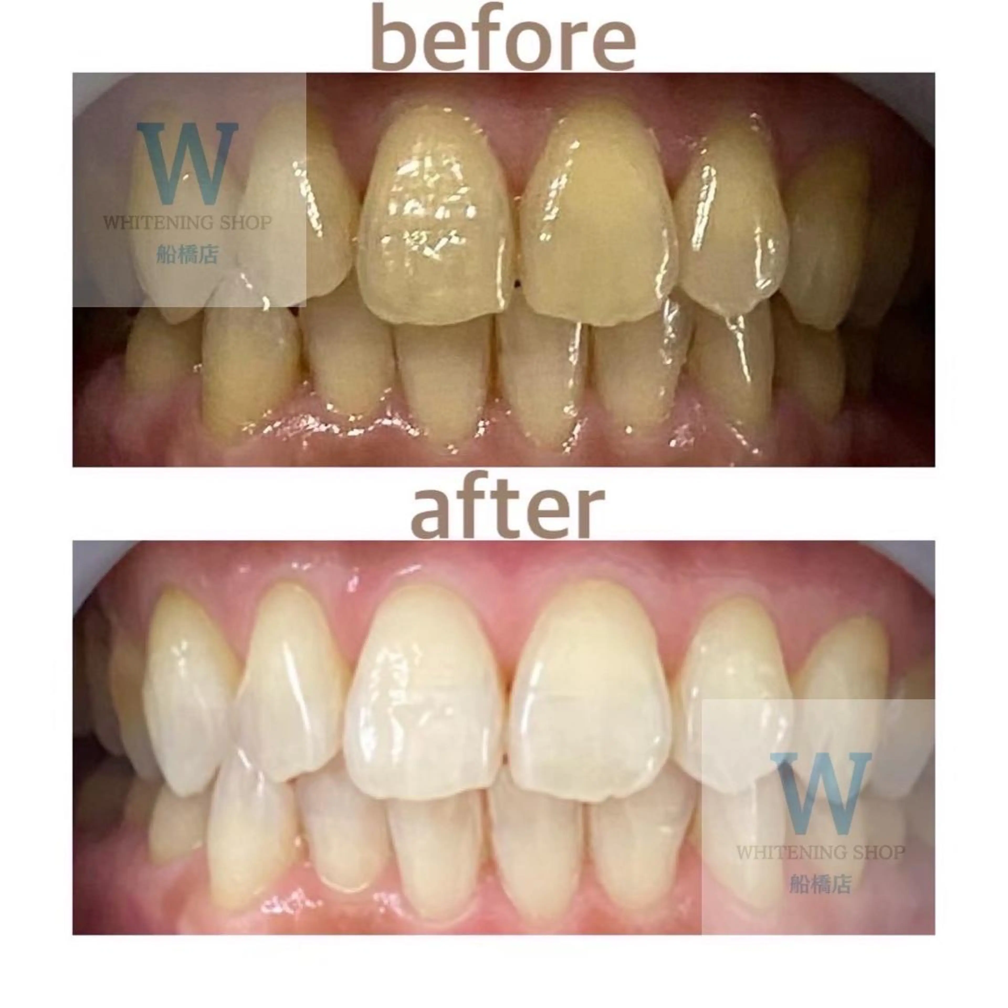 エステ リラク ホワイトニング ショップ船橋店🦷のエステ・リラクイメージ