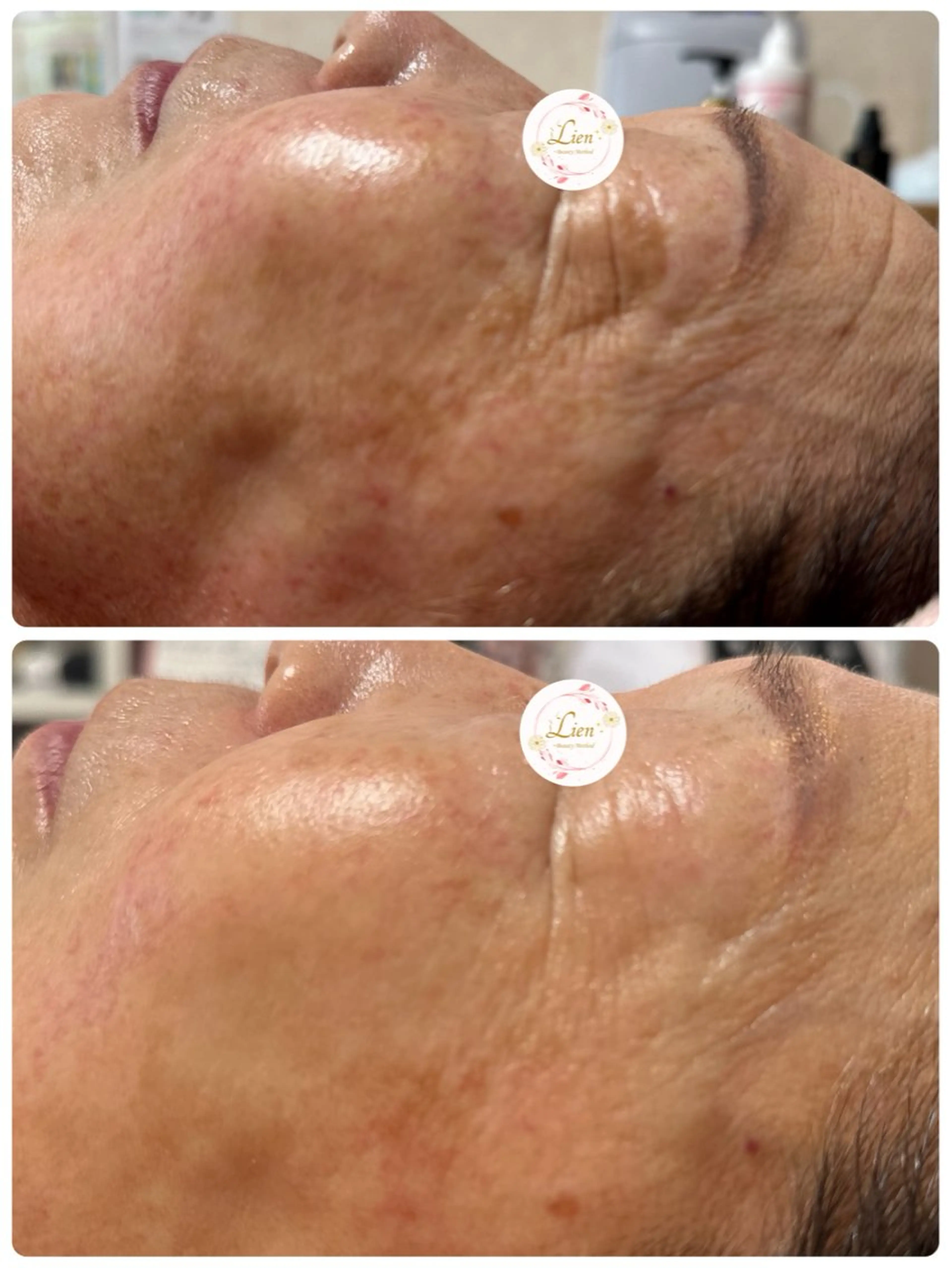 Lien オーナー　山口智嘉のエステ・リラクイメージ