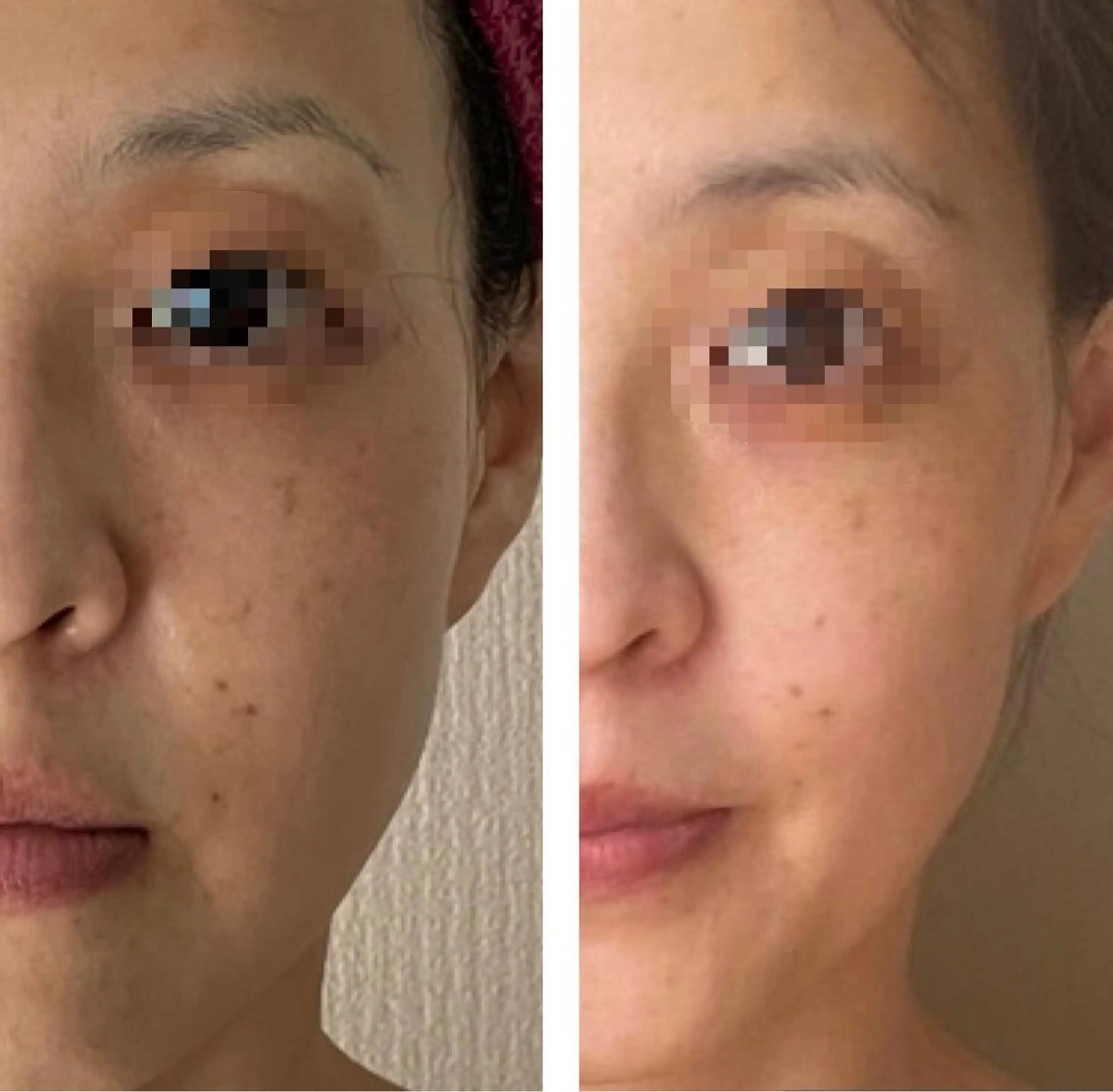 エステ 35歳からの エイジングケアサロンのエステ・リラクイメージ