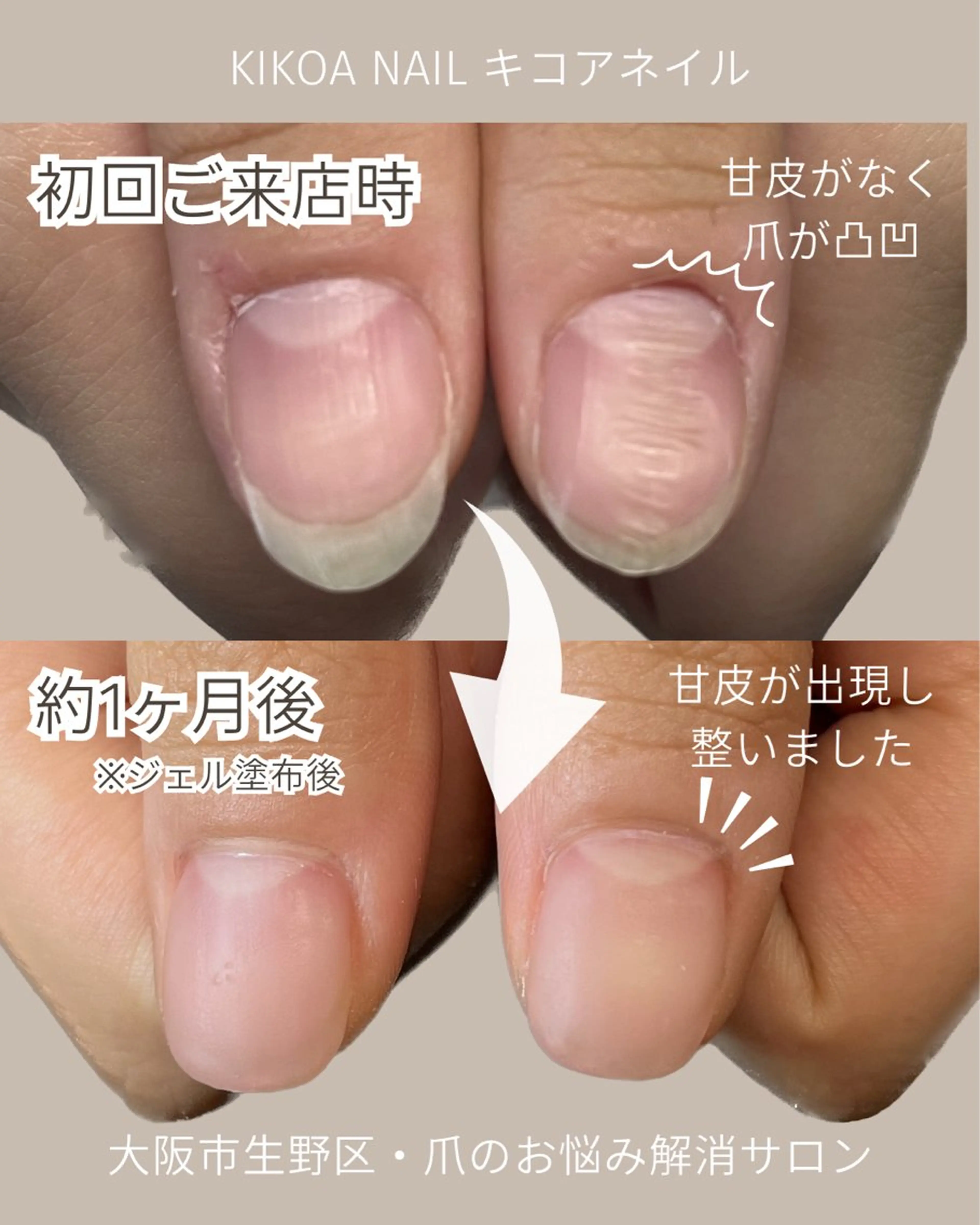 ネイル ジェルネイル KIKOA NAIL キコアネイルのネイルデザイン