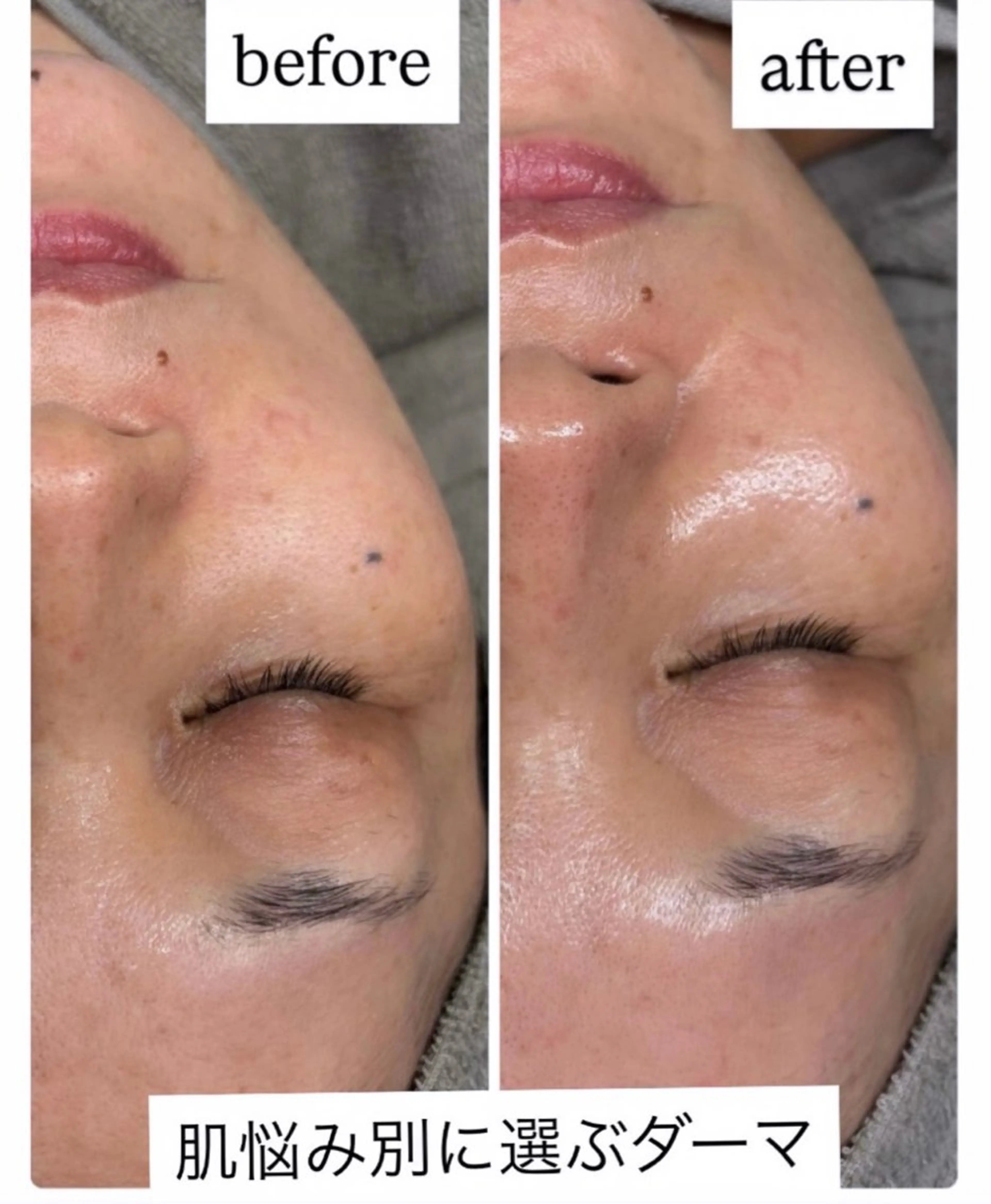 🌿肌管理×美眉 yuzu.の眉毛・アイブロウイメージ