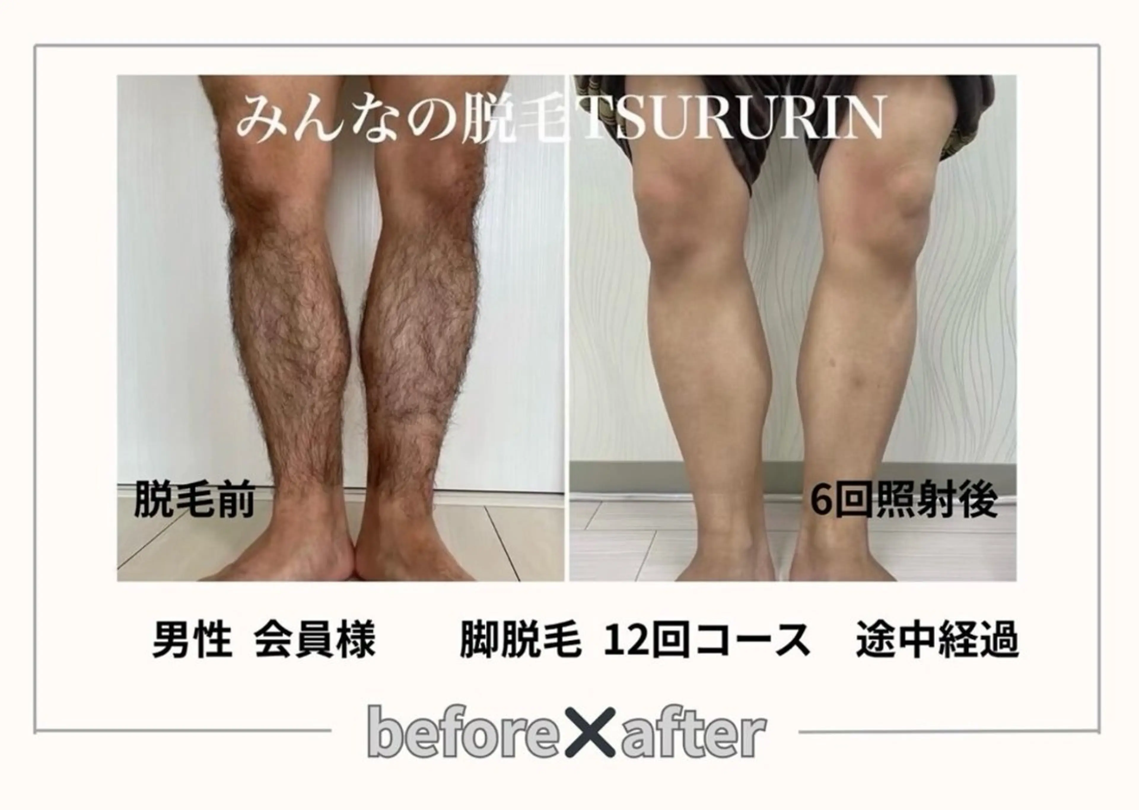 みんなの脱毛ツルリン ☀️船橋店☀️のエステ・リラクイメージ