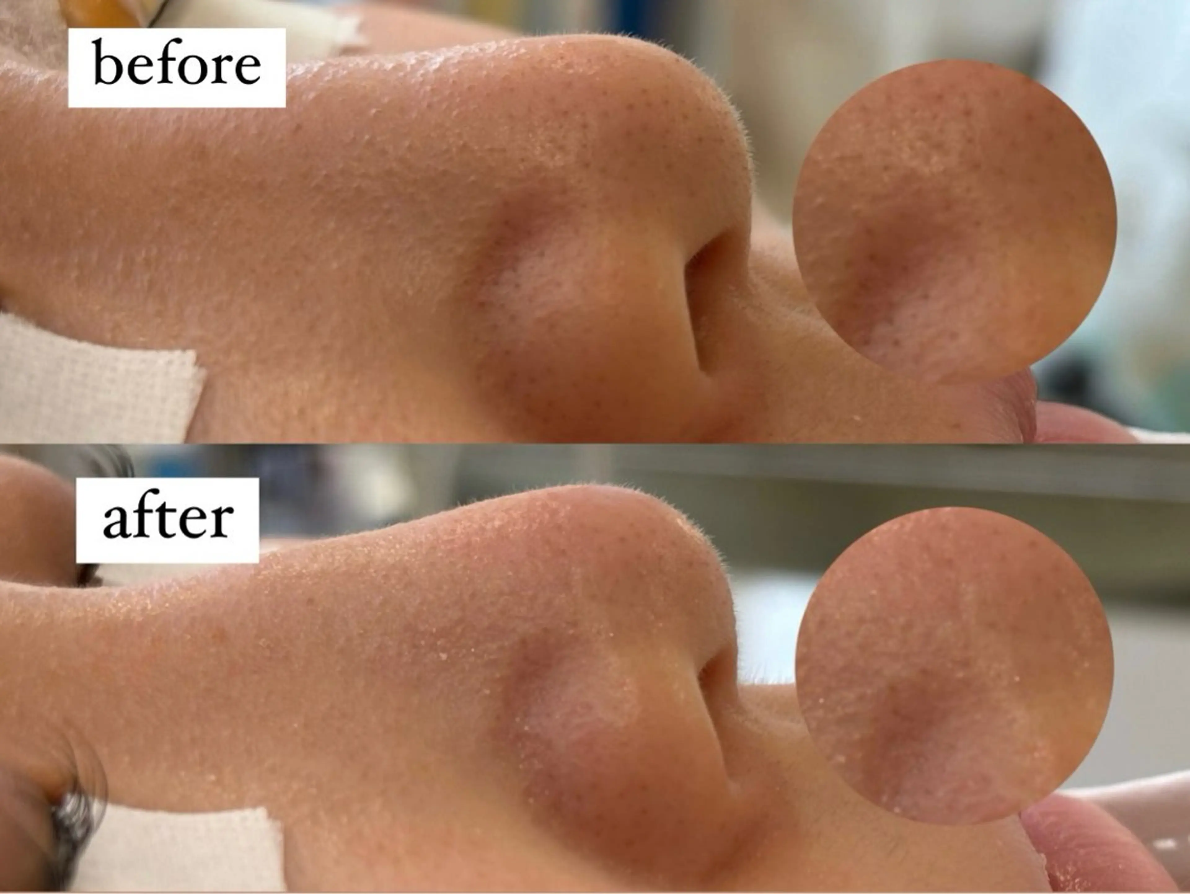 エステ Shelly Garden所属・kana🎀まつぱ/ ハーブピーリングの眉毛・アイブロウイメージ