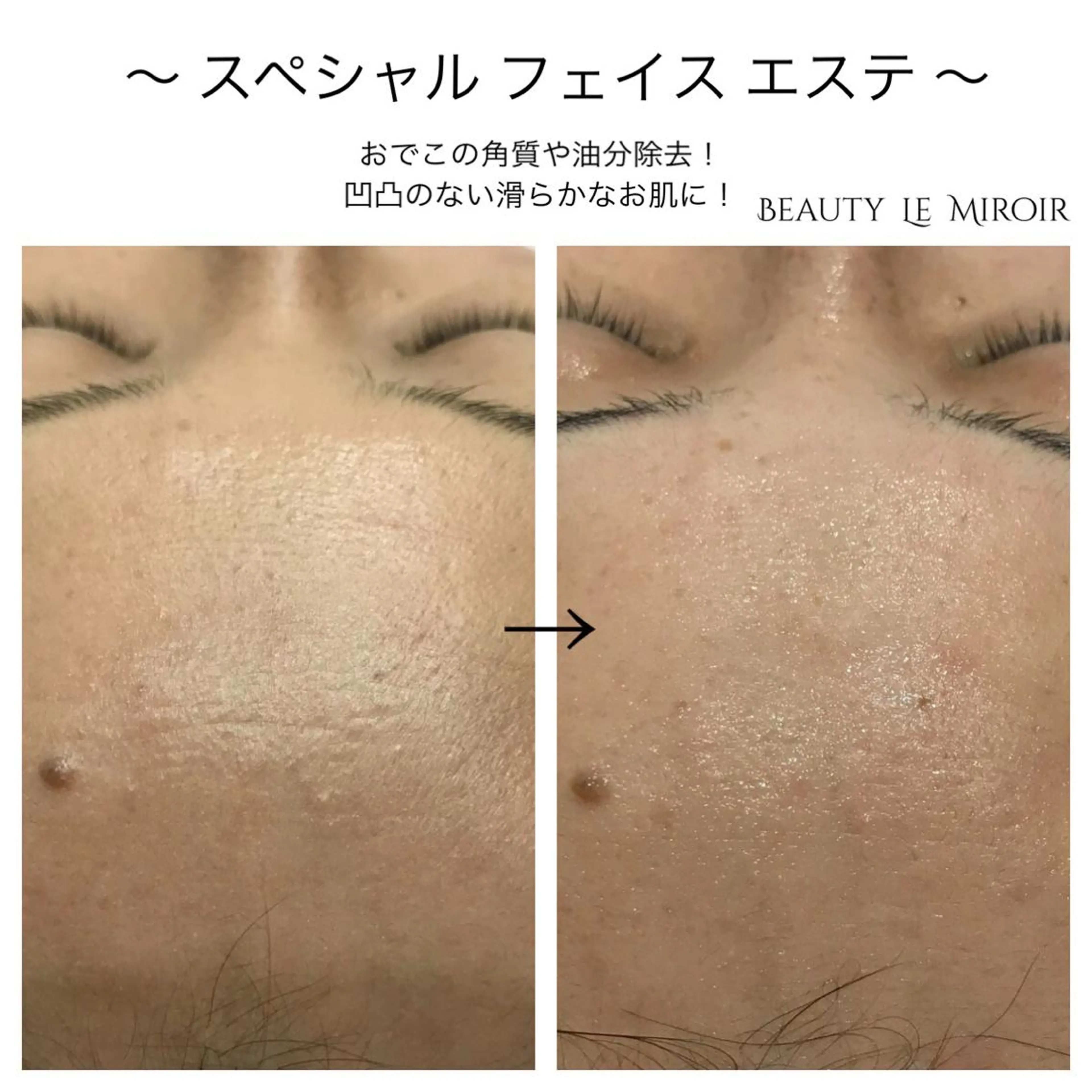 ビューティー ミロワールのエステ・リラクイメージ