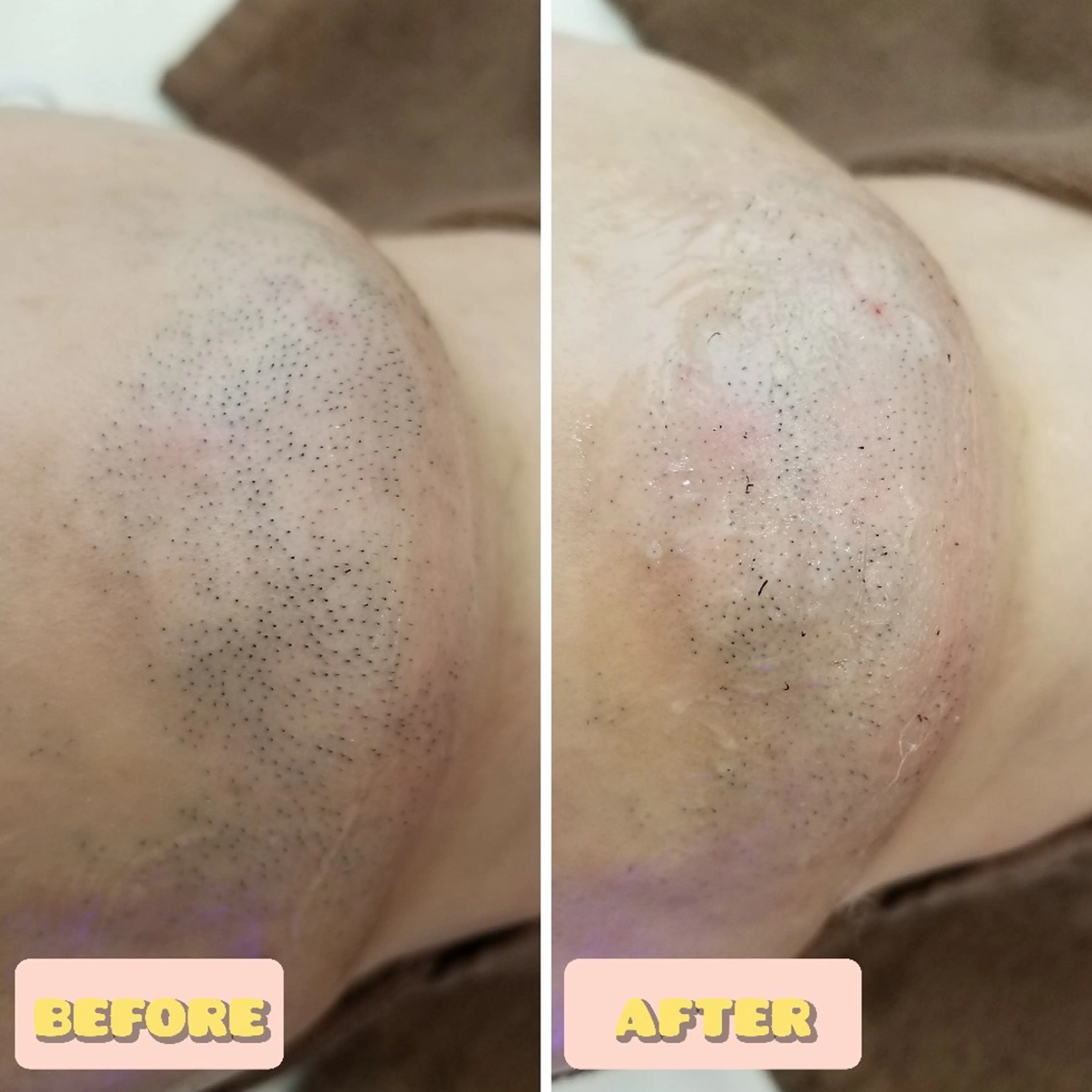 メンズ 脱毛 Reid -月詠-のエステ・リラクイメージ