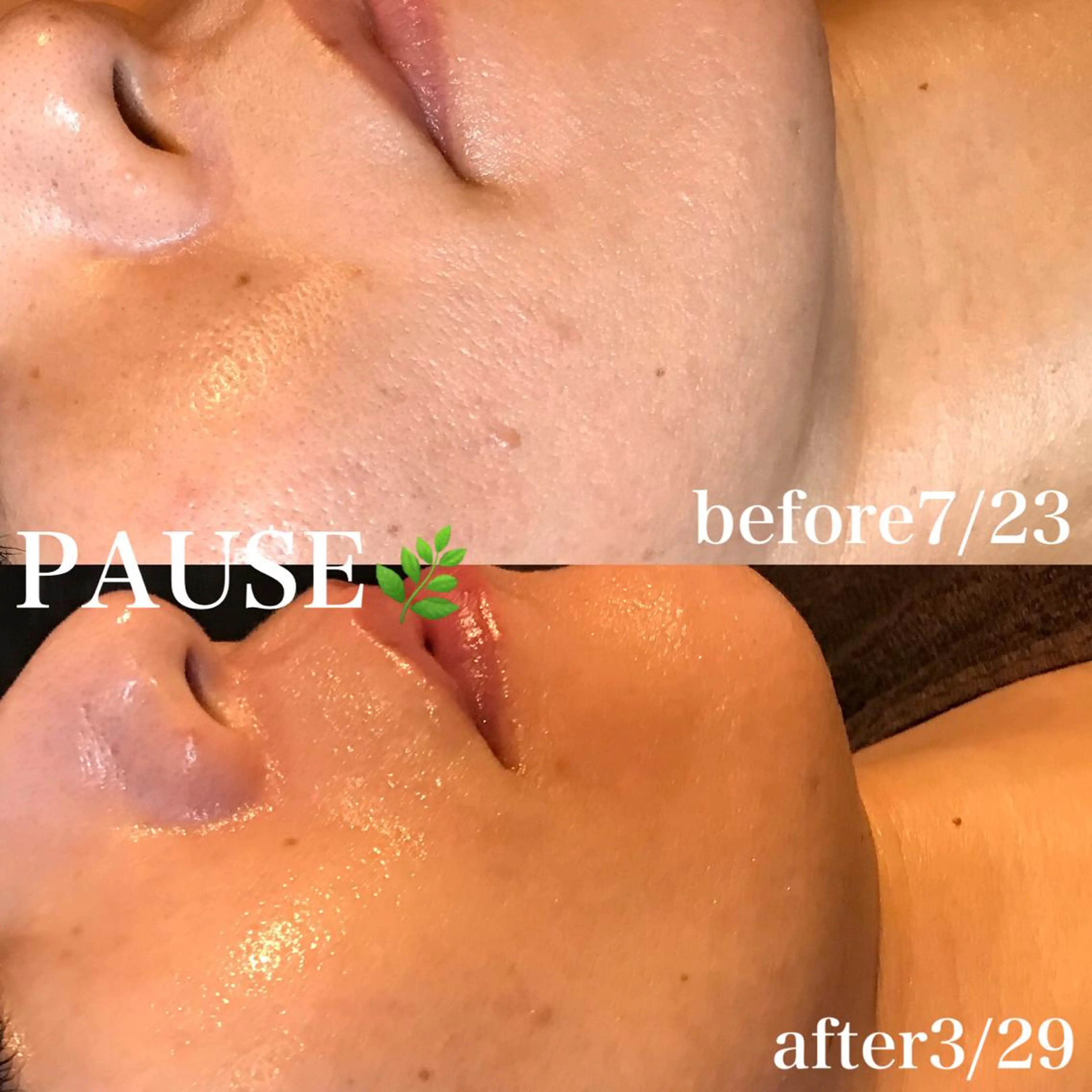 エステ 浜野 恵美のエステ・リラクイメージ