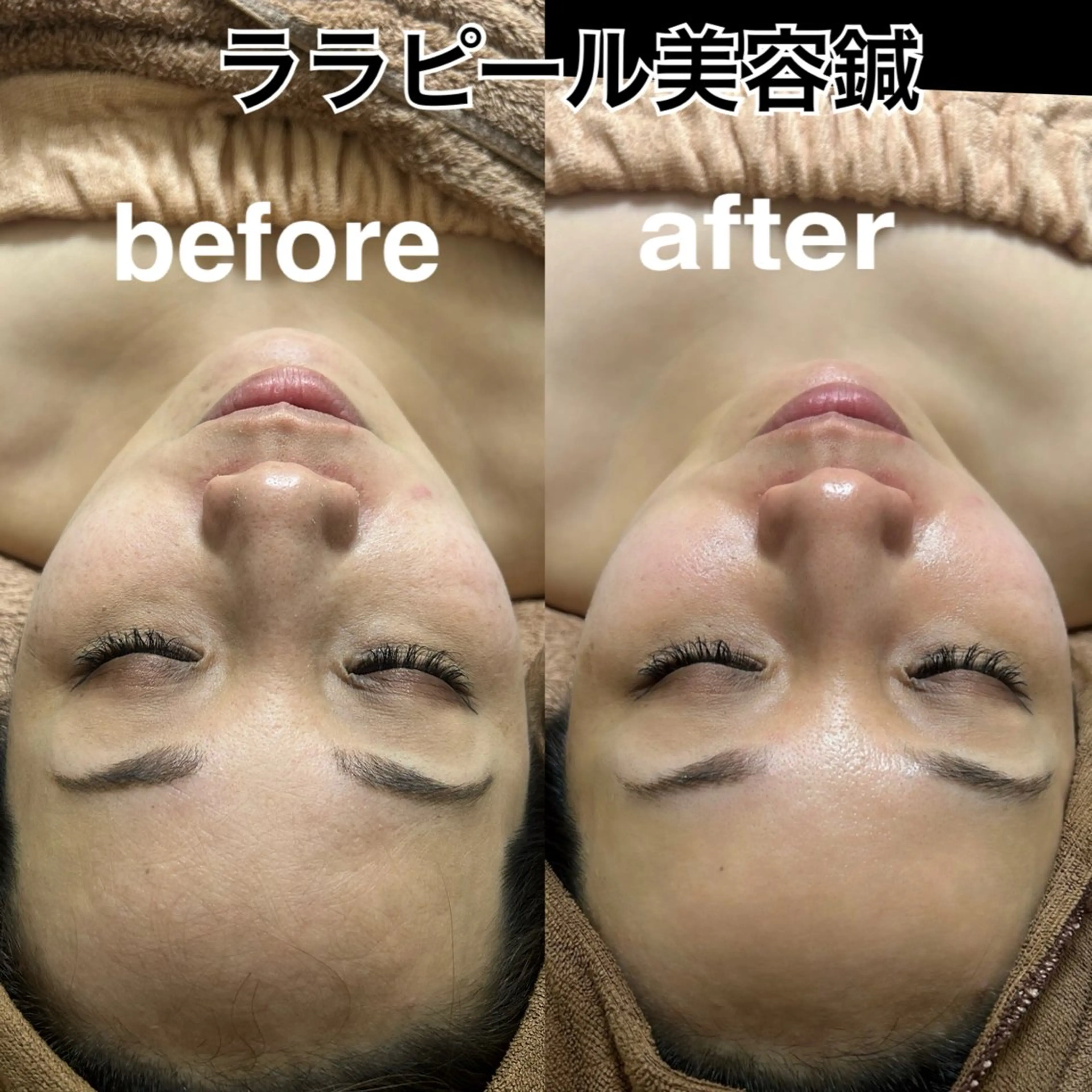 エステ リラク 美容鍼灸サロン mahoroba院長のエステ・リラクイメージ