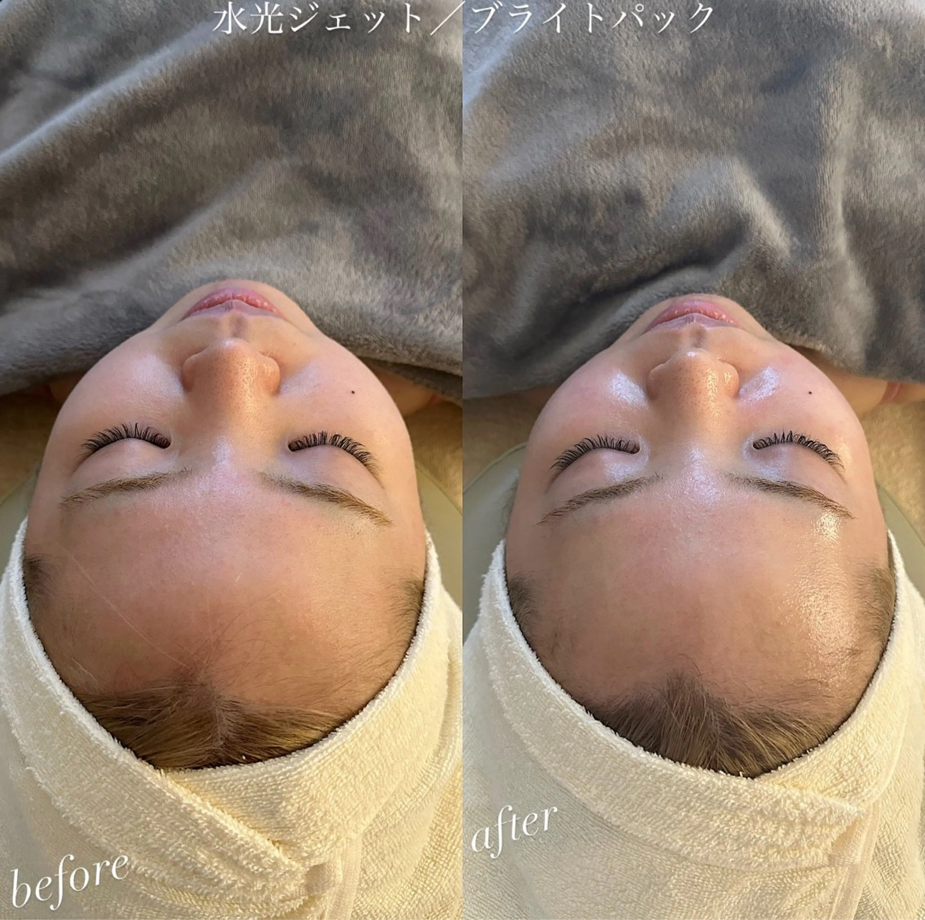 エステ うなじ脱毛/美肌脱毛 LABELのエステ・リラクイメージ