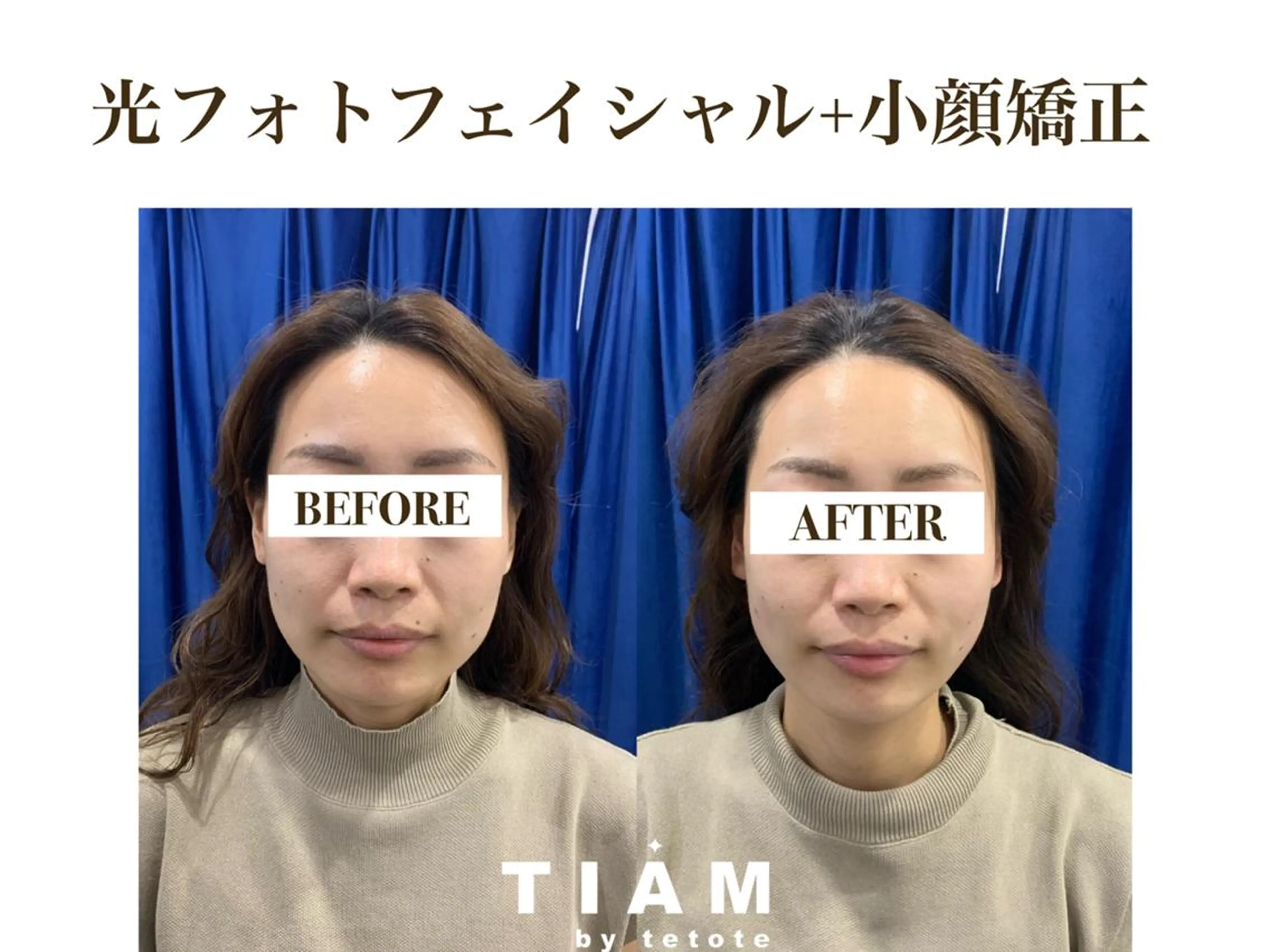 美肌サロンTIAM by tetoteのエステ・リラクイメージ