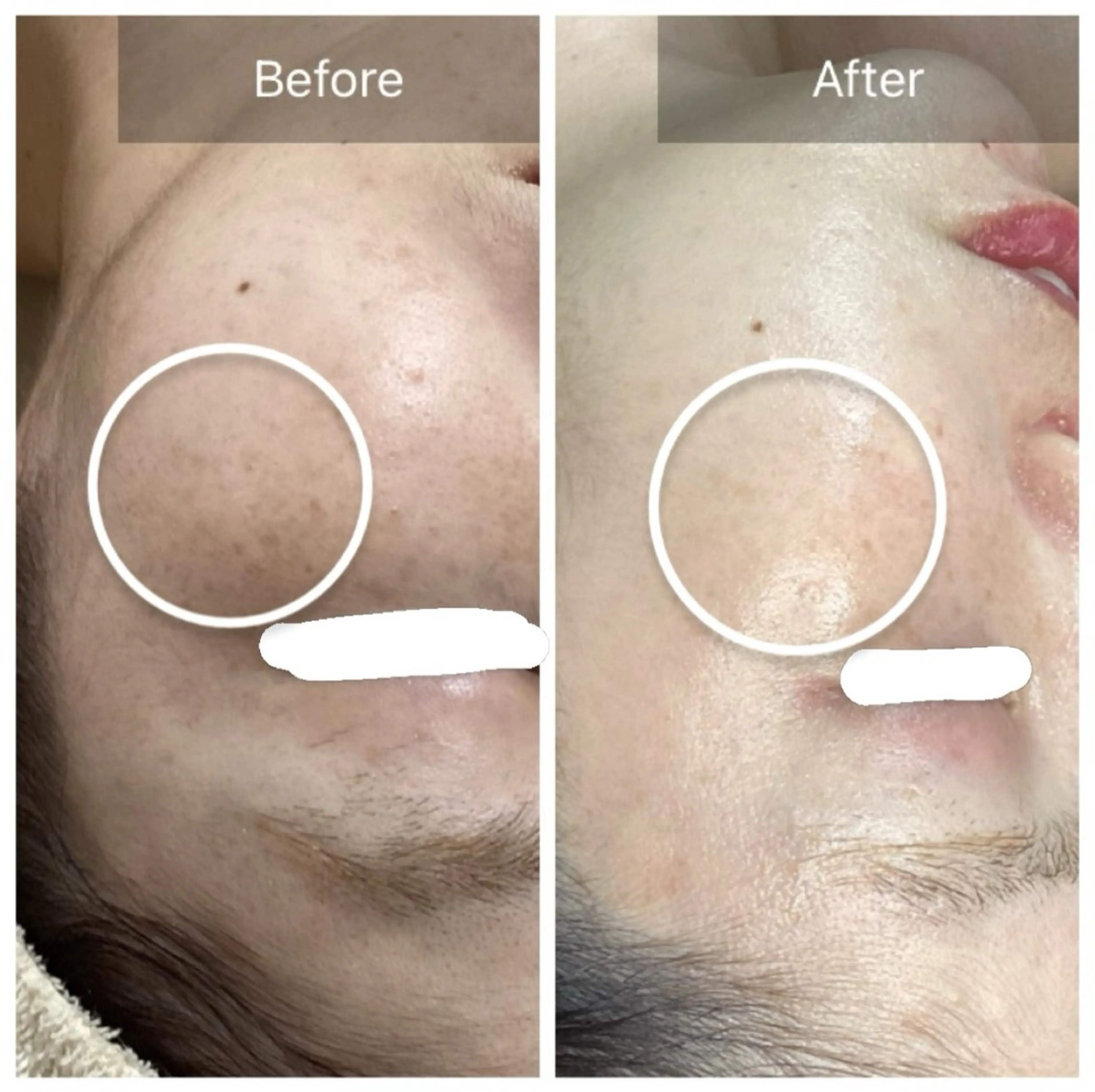 エステ Dahlia Moriのエステ・リラクイメージ