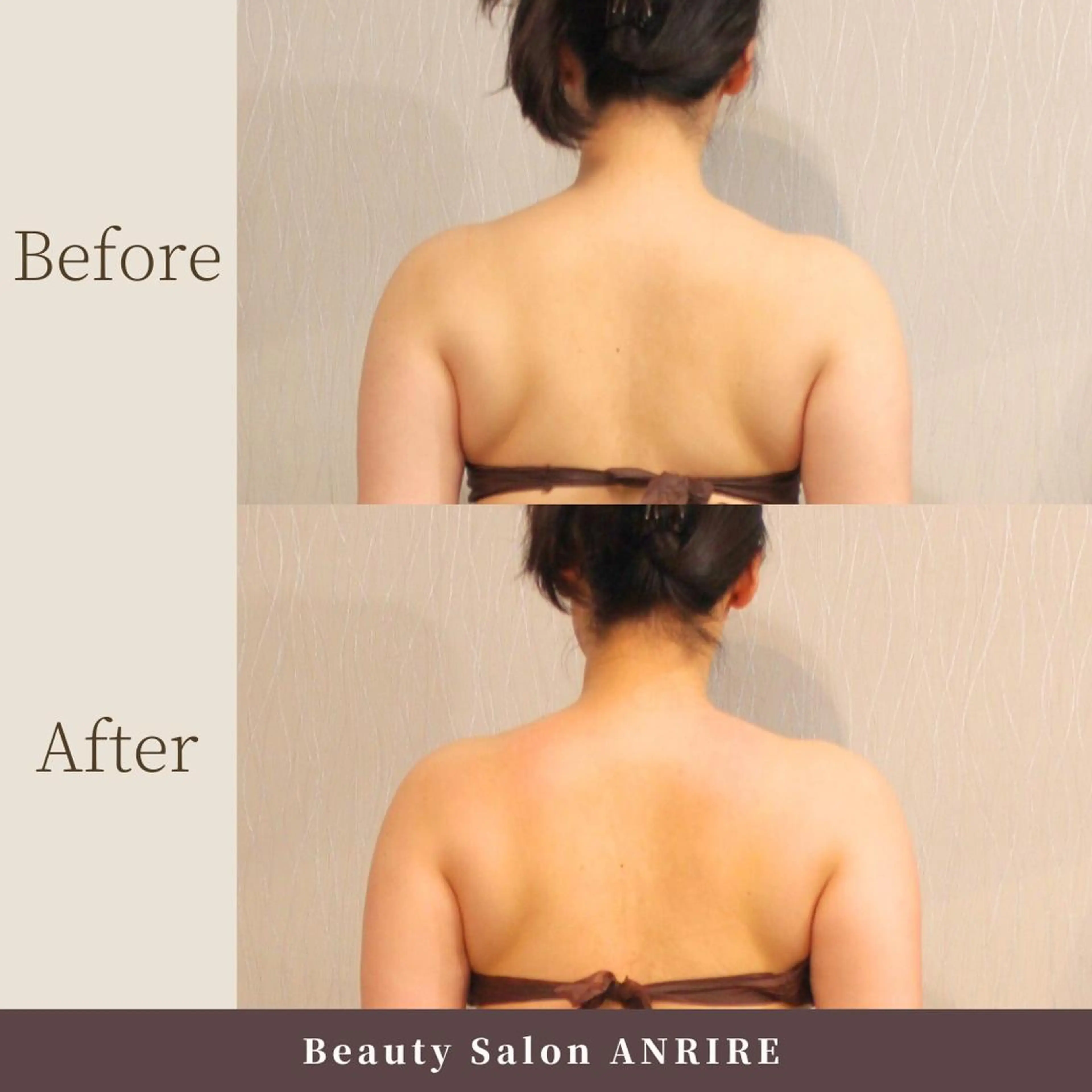 ANRIRE (アンリール)のエステ・リラクイメージ