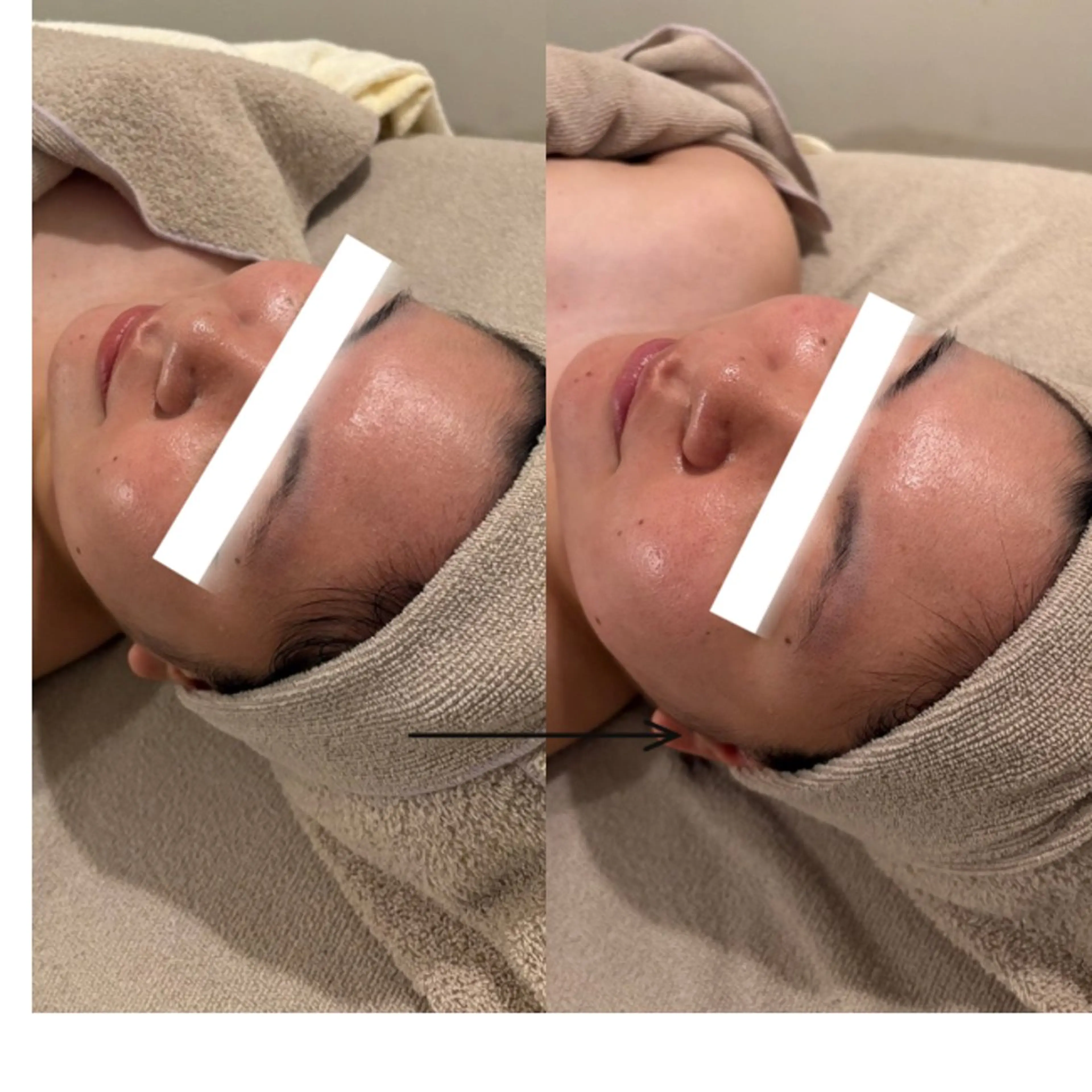 UEDA | POLA 天王寺のエステ・リラクイメージ