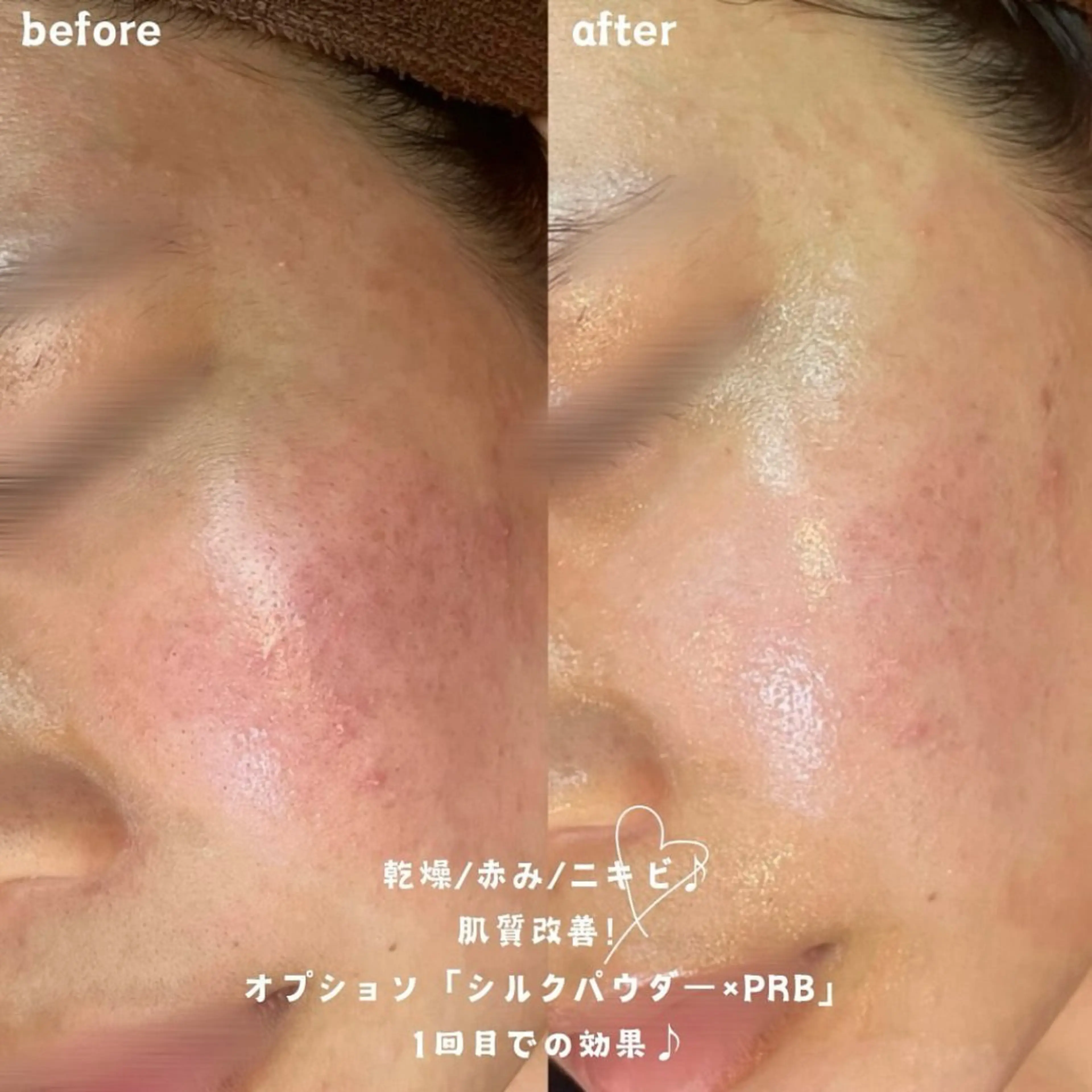 NA skin たまプラーザ　川島のエステ・リラクイメージ