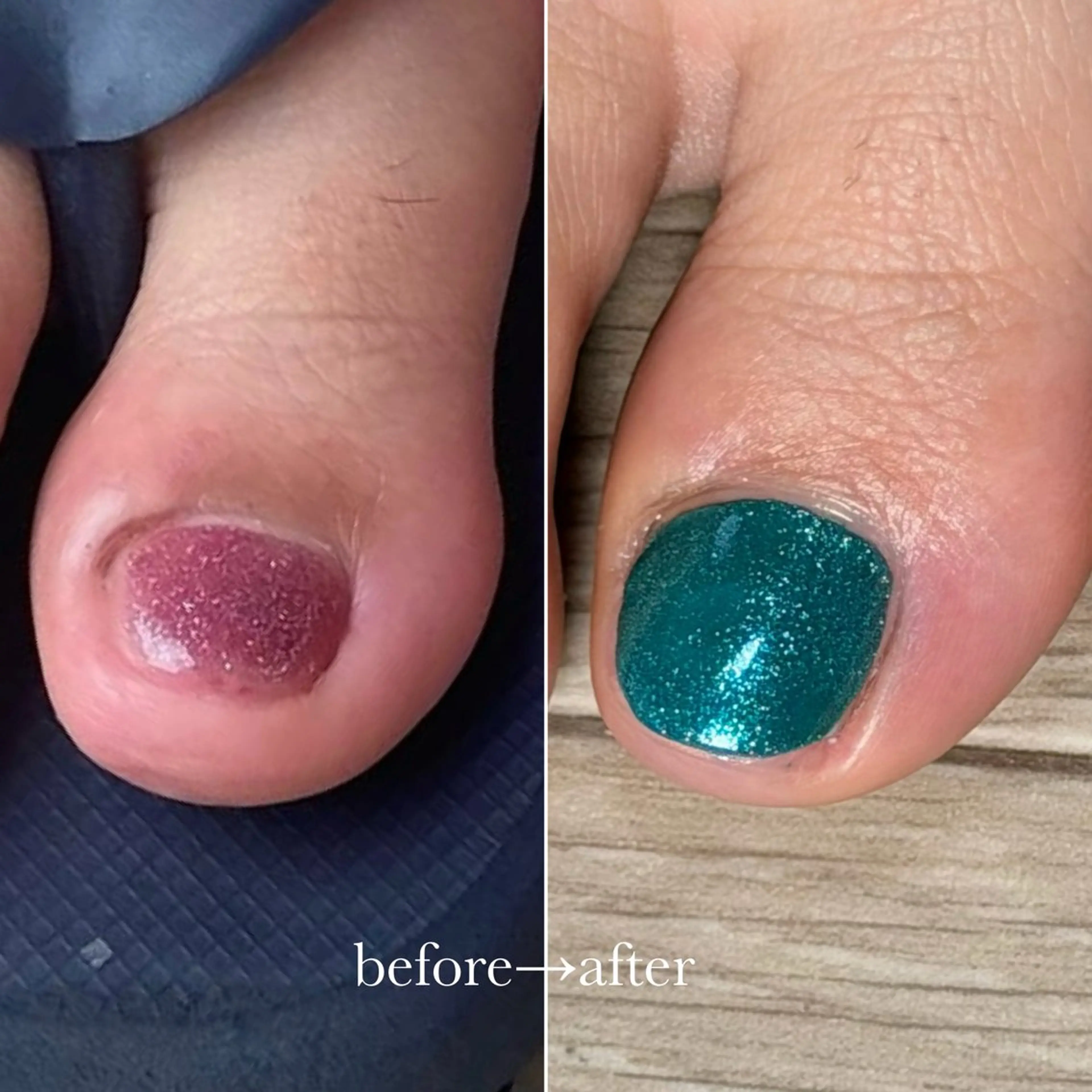 「足指育成」ワンカラーの写真