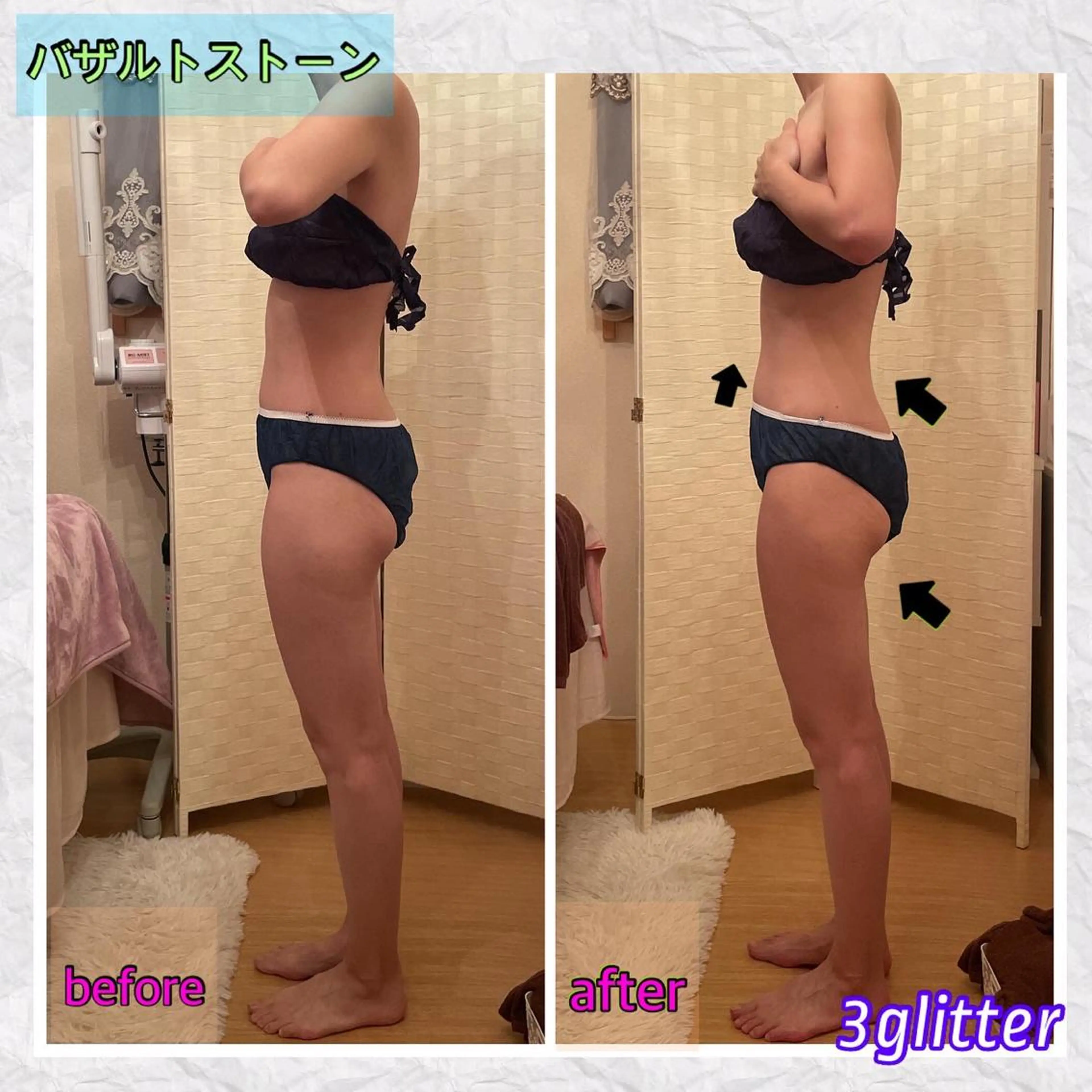 3glitter 肌質改善＆痩身のエステ・リラクイメージ
