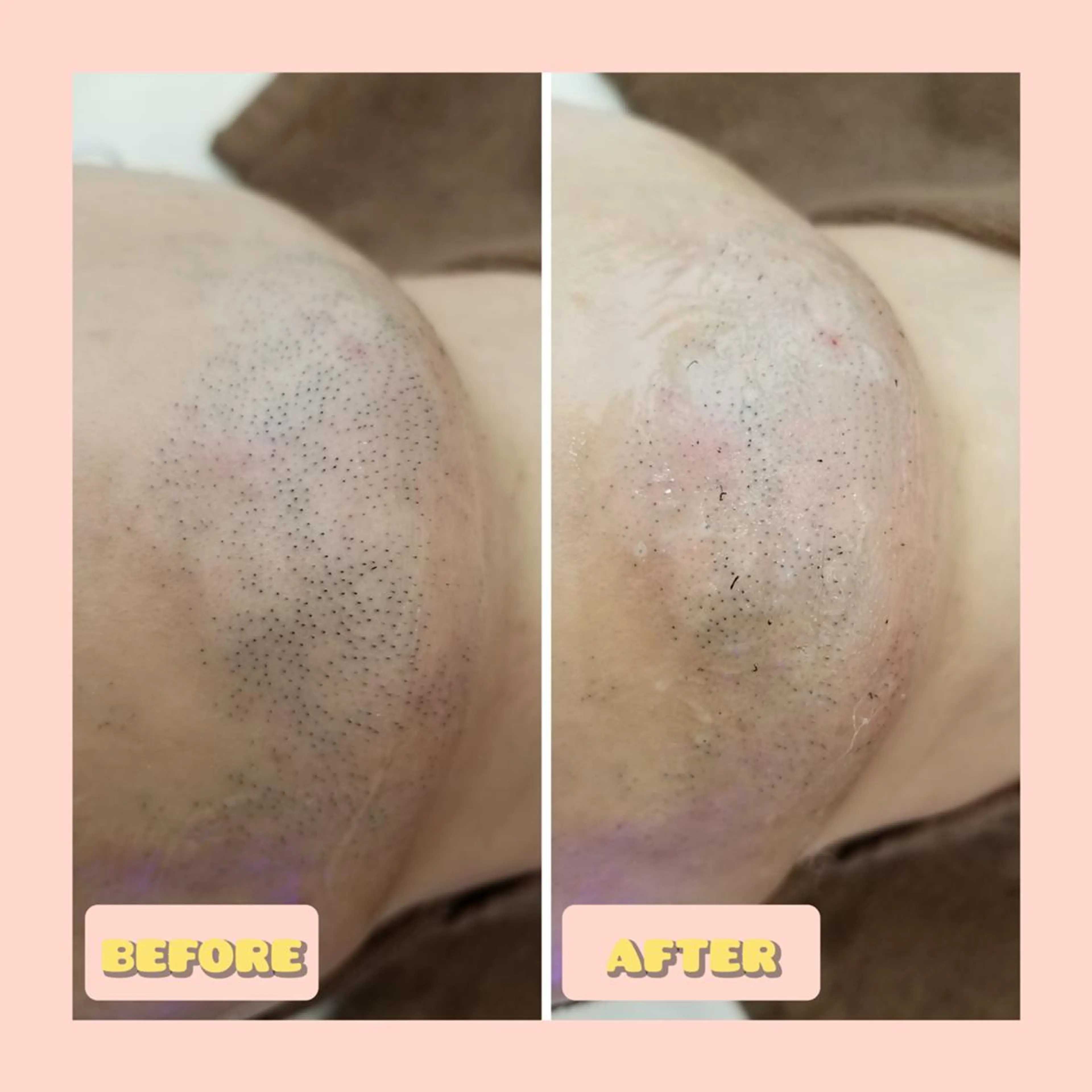 脱毛 salonde ReGodのエステ・リラクイメージ