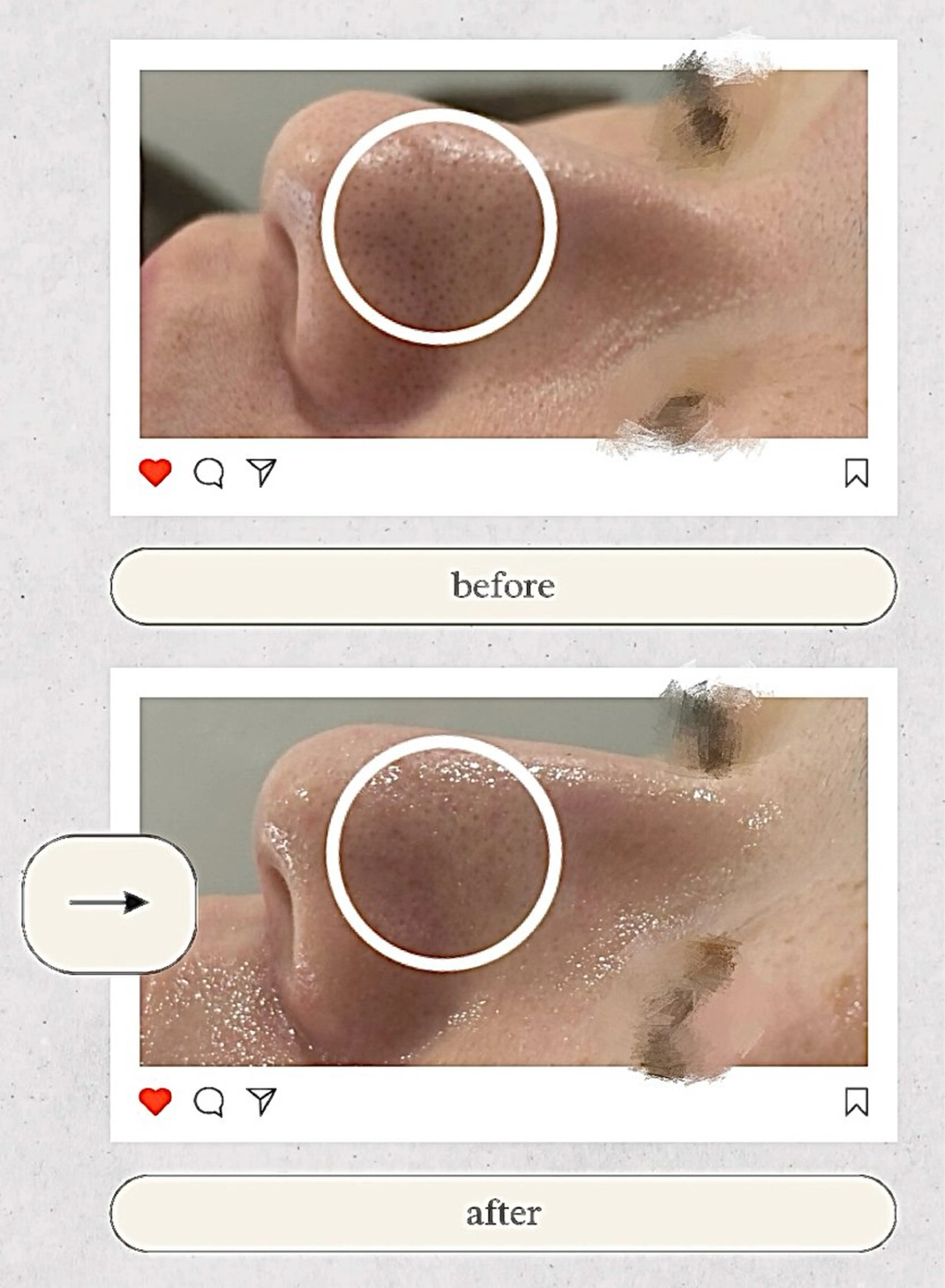 エステ AY'S所属・倉敷/玉島/20代 からの大人毛穴洗浄のエステ・リラクイメージ