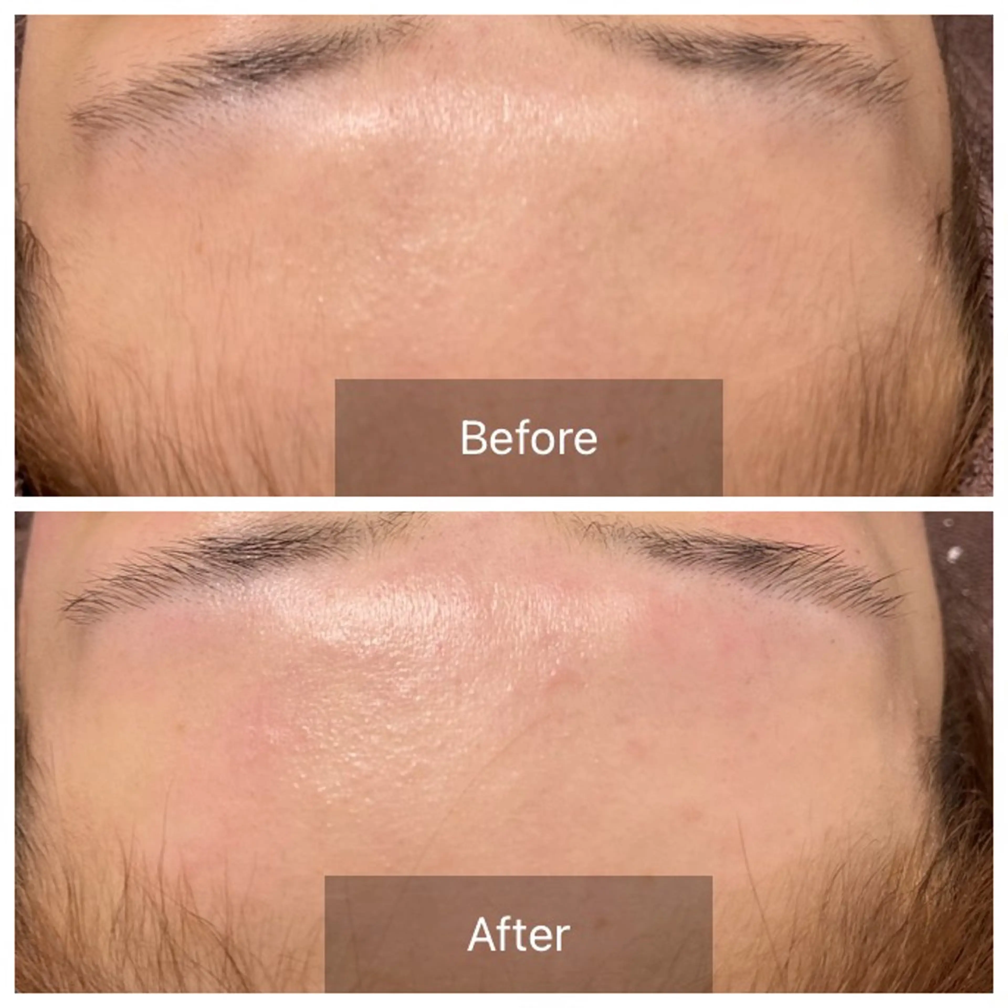 エステ 産毛専門店 Bittoのエステ・リラクイメージ