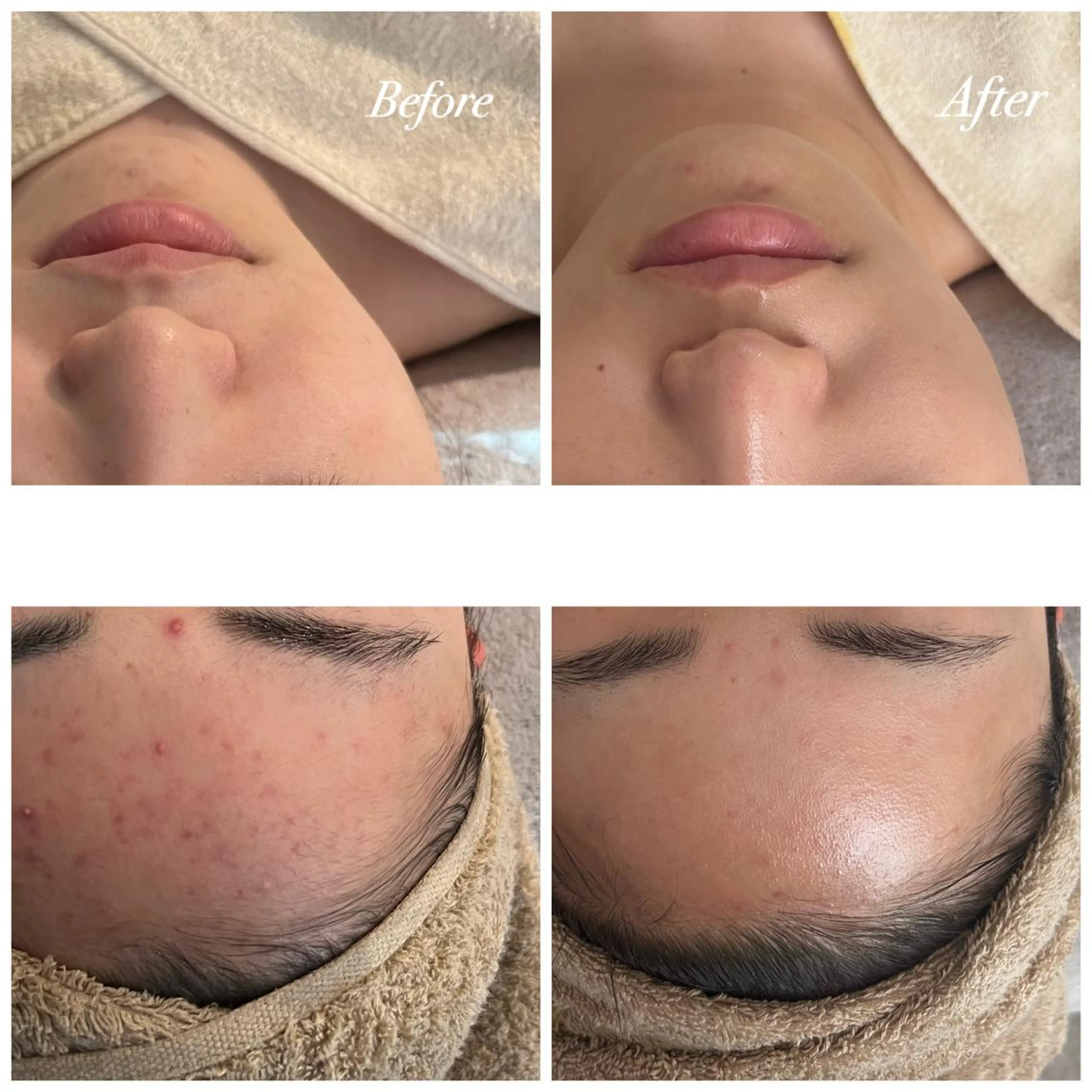 エステ リラク Plaran 〜プララン 〜のその他イメージ