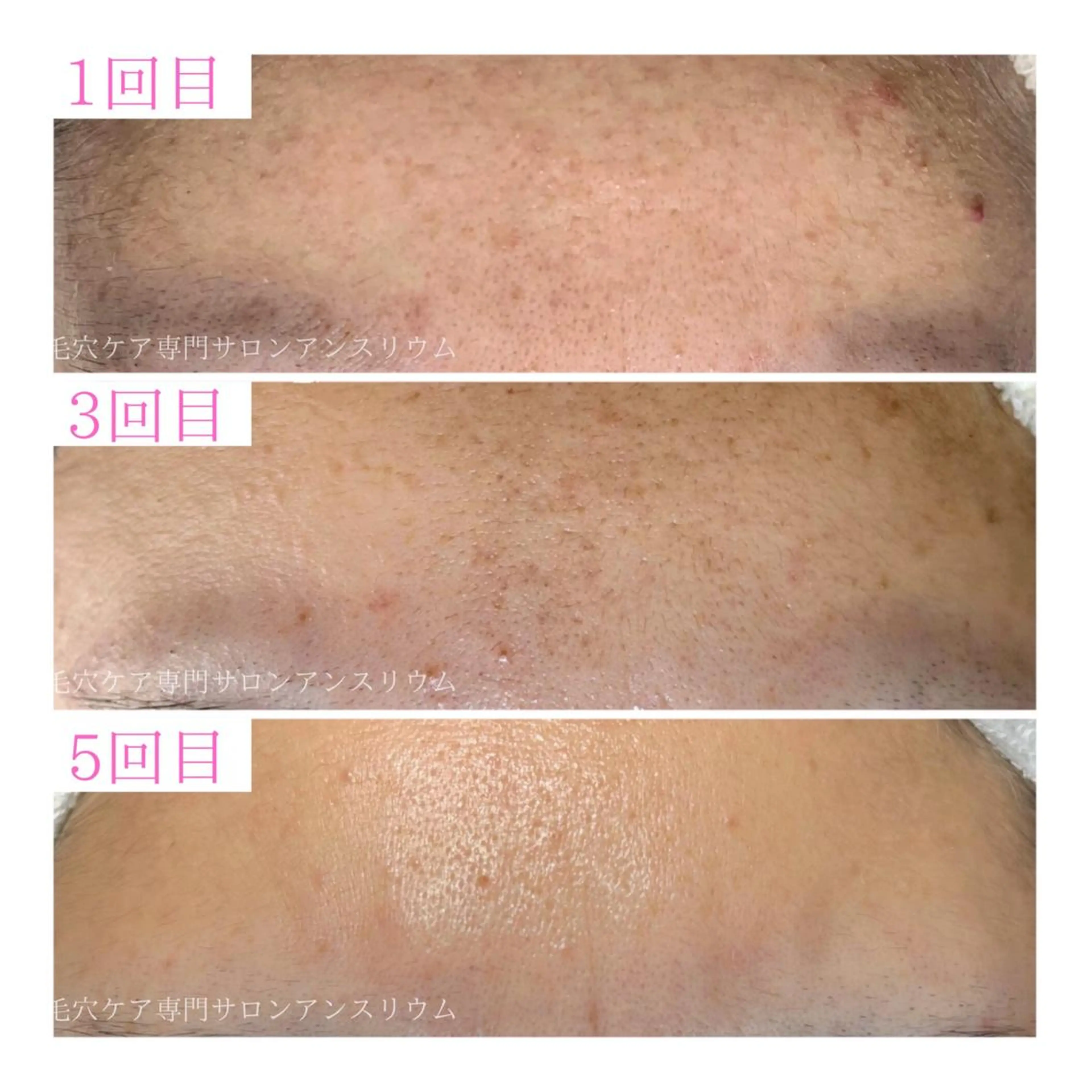 茨城土浦 つくば毛穴 ケア専門サロンのエステ・リラクイメージ