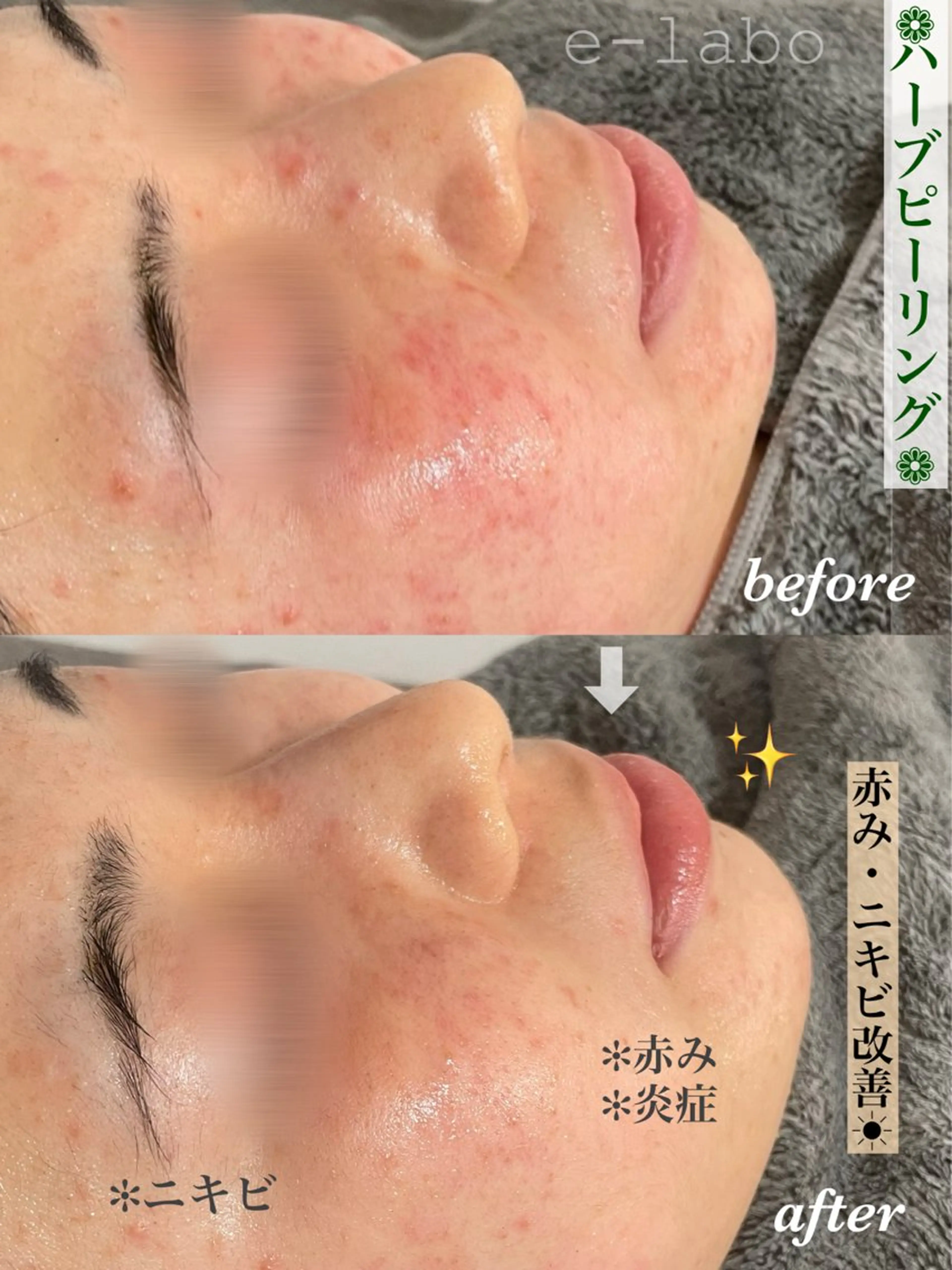 e-LABO こいずみのエステ・リラクイメージ