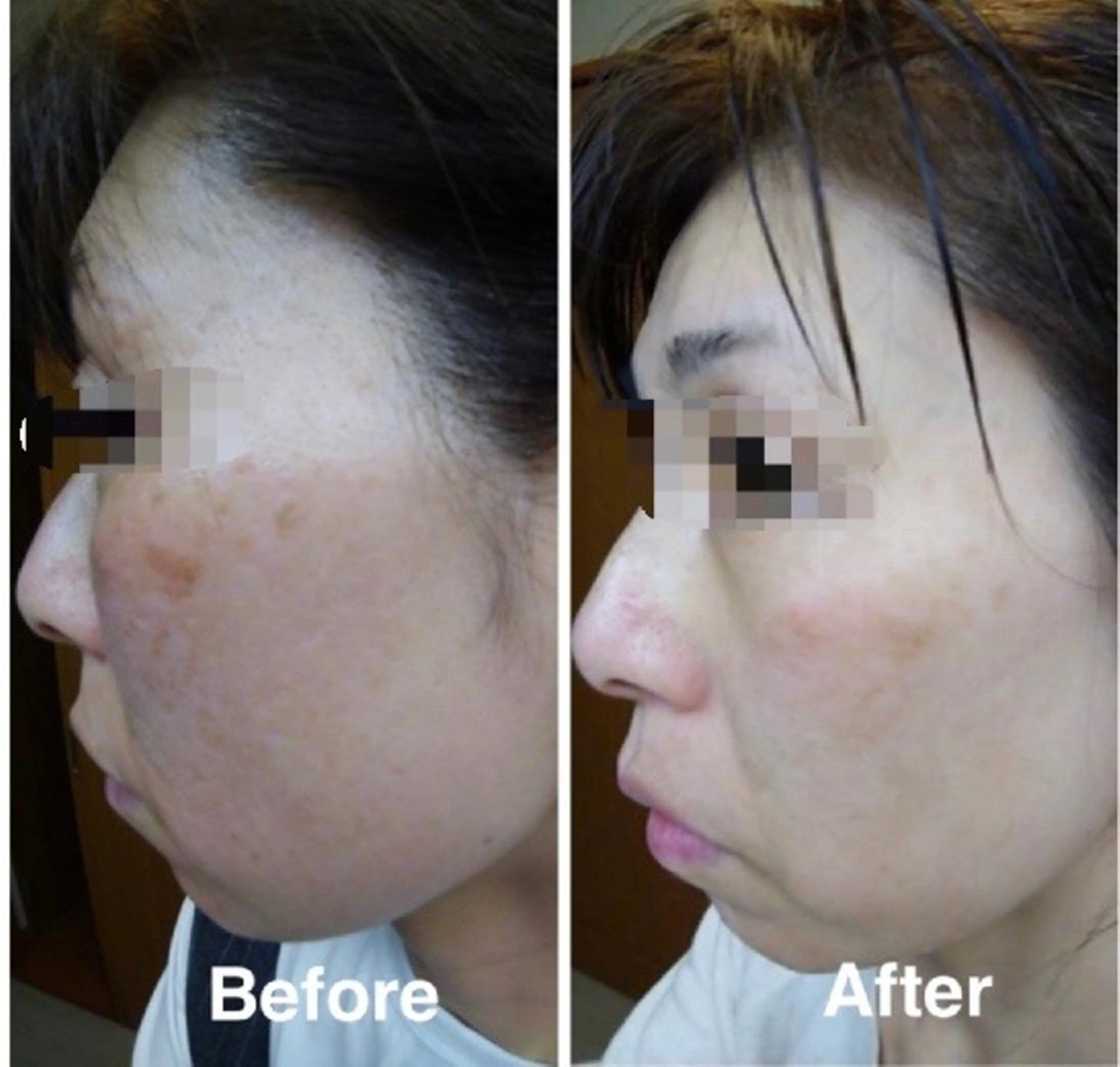 eyelist Asamiのマツエク・マツパデザイン