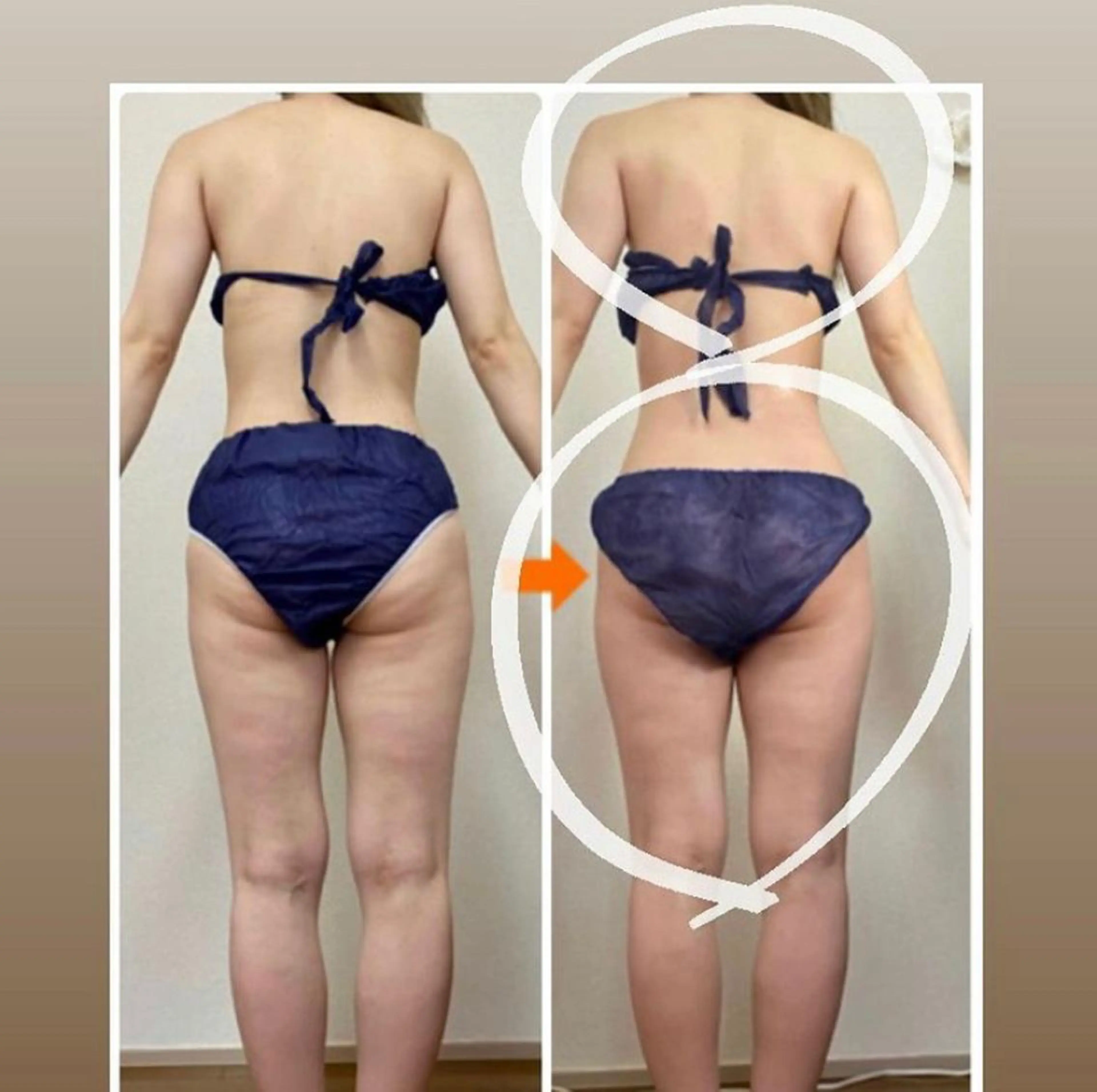 ショート カラー パーマ ヘアアレンジ メンズ キッズ ネイル マツエク・マツパ エステ リラク ‍痩身＆ボディ 結果出し🌟丹野のエステ・リラクイメージ