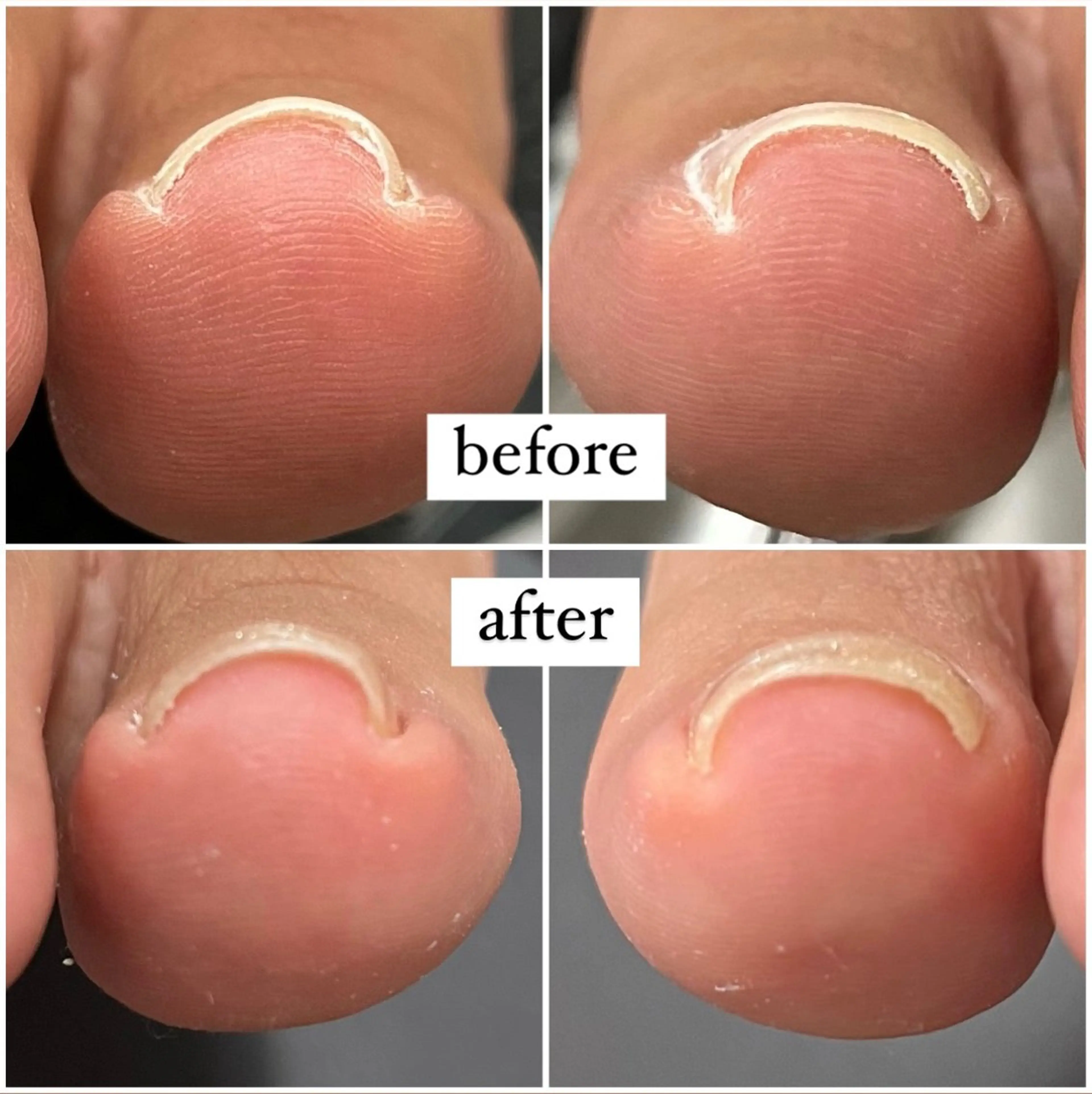 ネイル ジェルネイル フットネイル kupu所属・ネイルサロン kupuのネイルデザイン