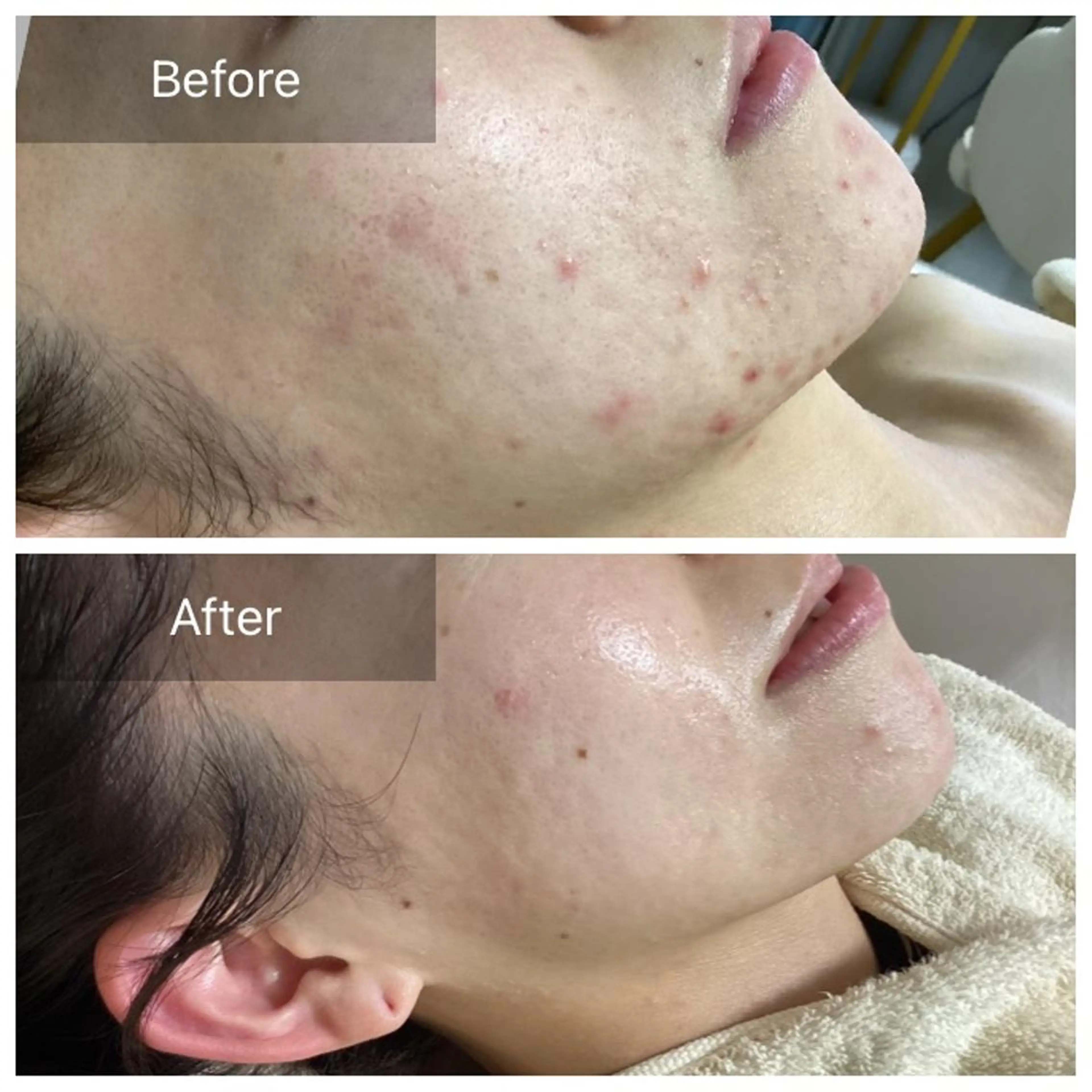 エステ Dahlia Moriのエステ・リラクイメージ