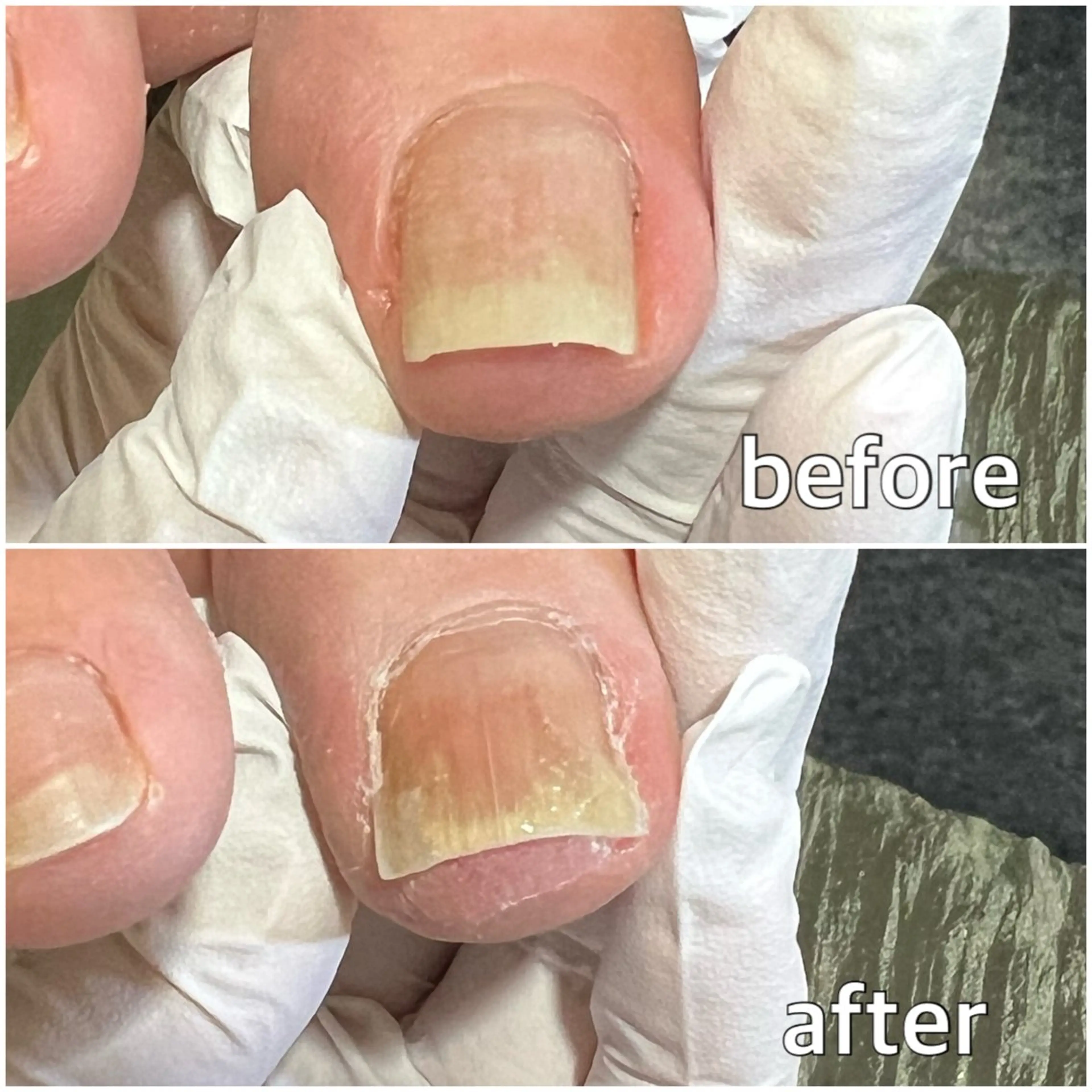 ネイル ジェルネイル フットネイル 巻き爪補正店 堺東店のネイルデザイン