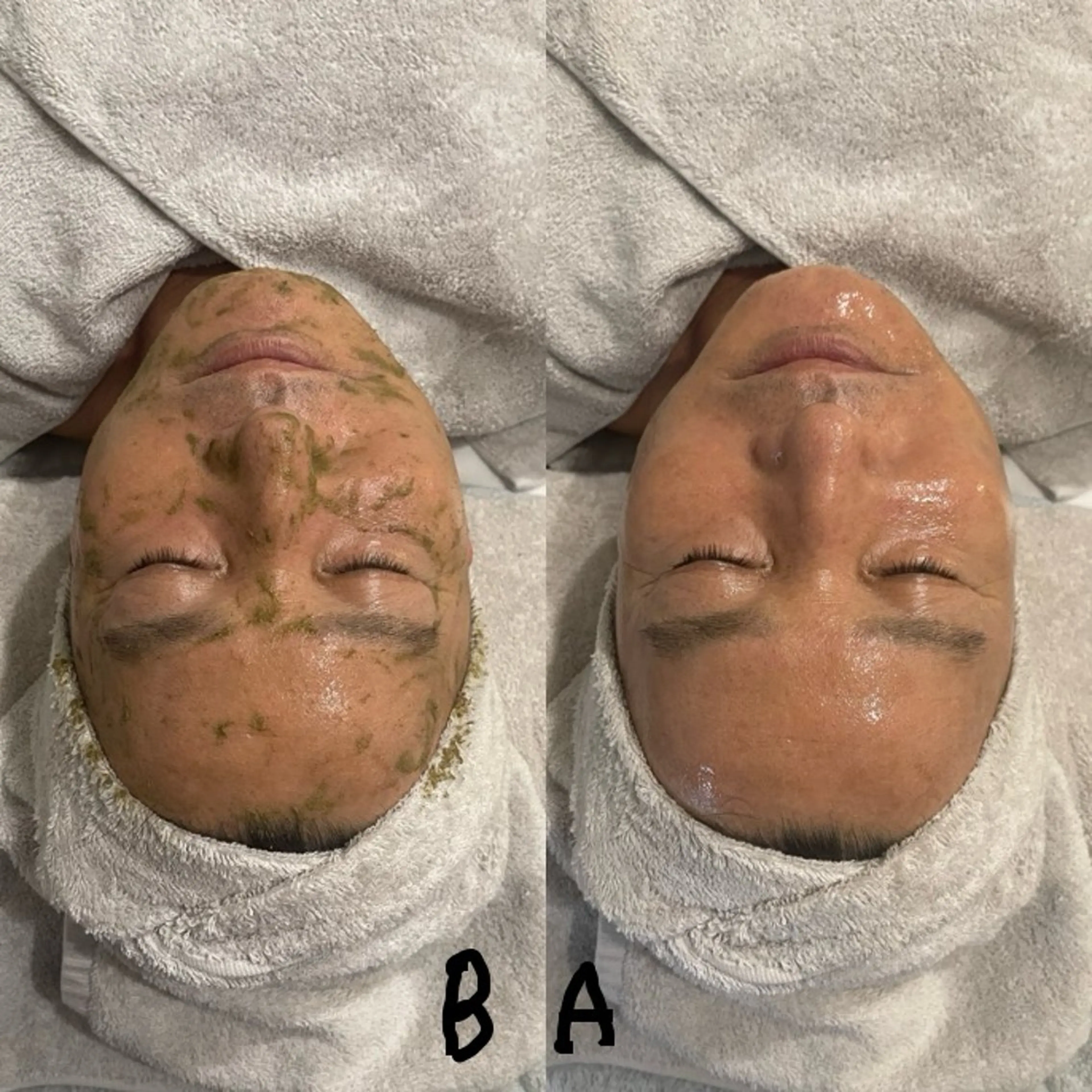 エステ 体質改善に特化した パーソナルサロン88のエステ・リラクイメージ