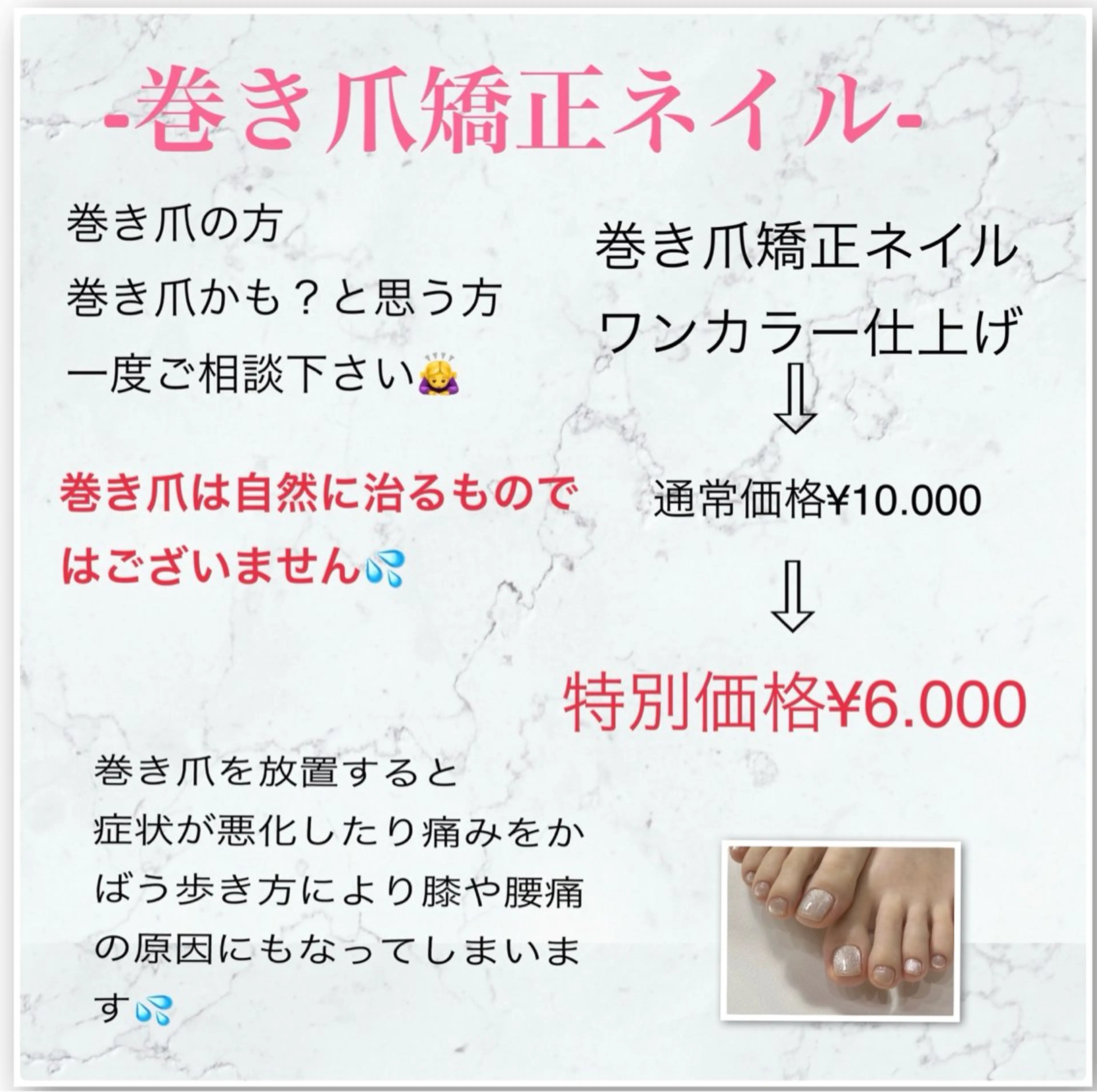 ネイル フットネイル Nail ecxia ／Reikaのネイルデザイン