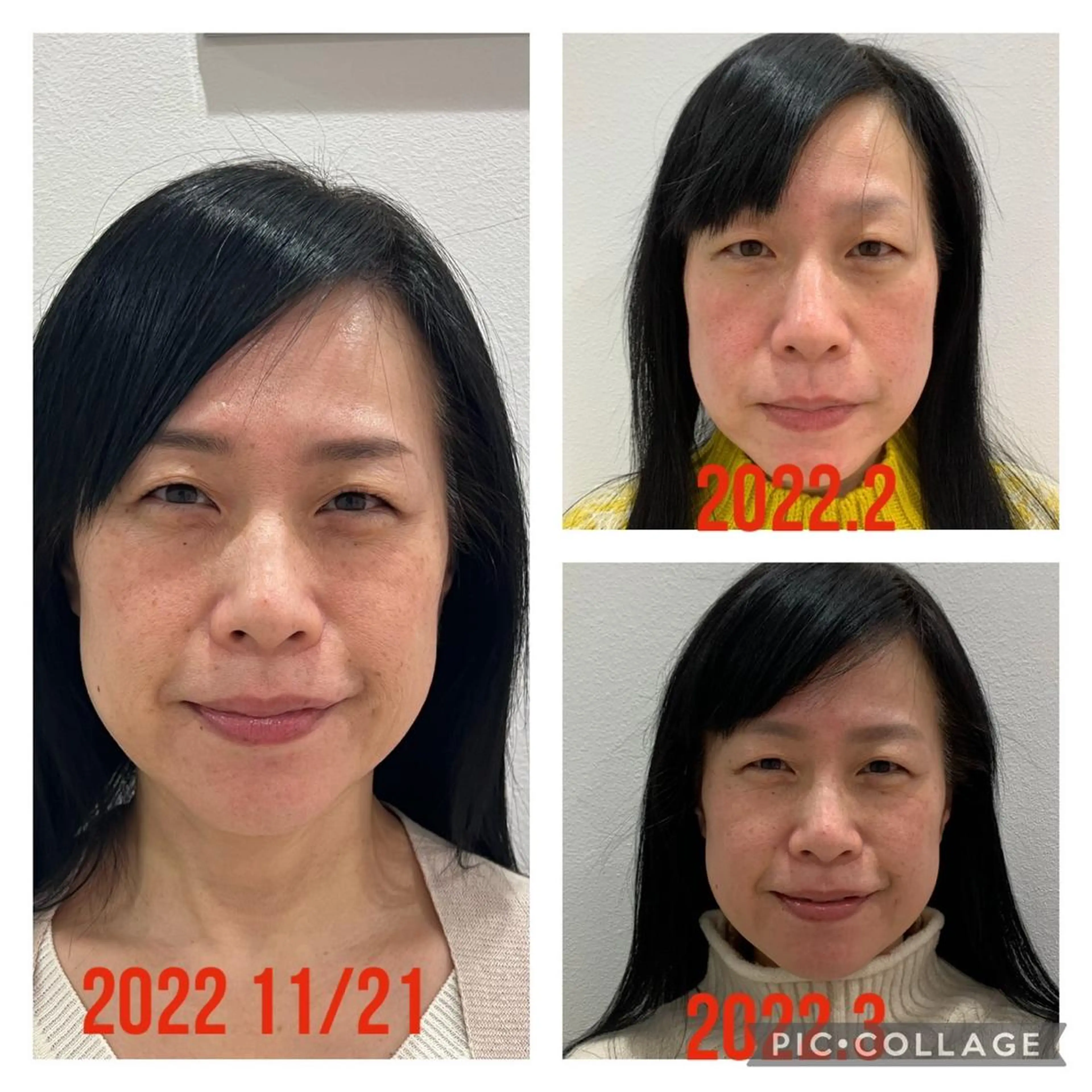 エステ 丸の内ヒルズ 今井琴恵のその他イメージ