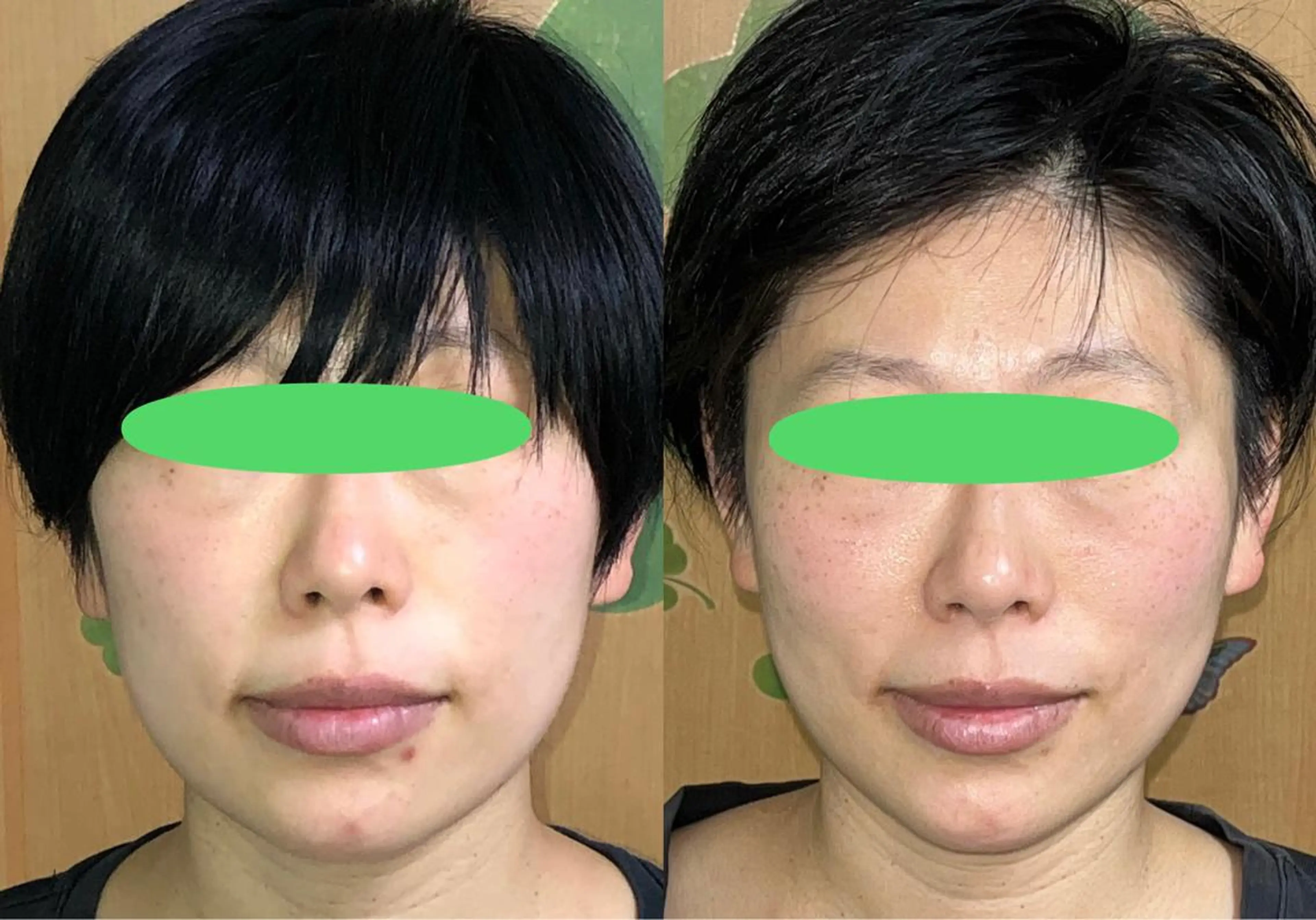 エステ リラク 春日井トータルからだ サロンふくふくのエステ・リラクイメージ