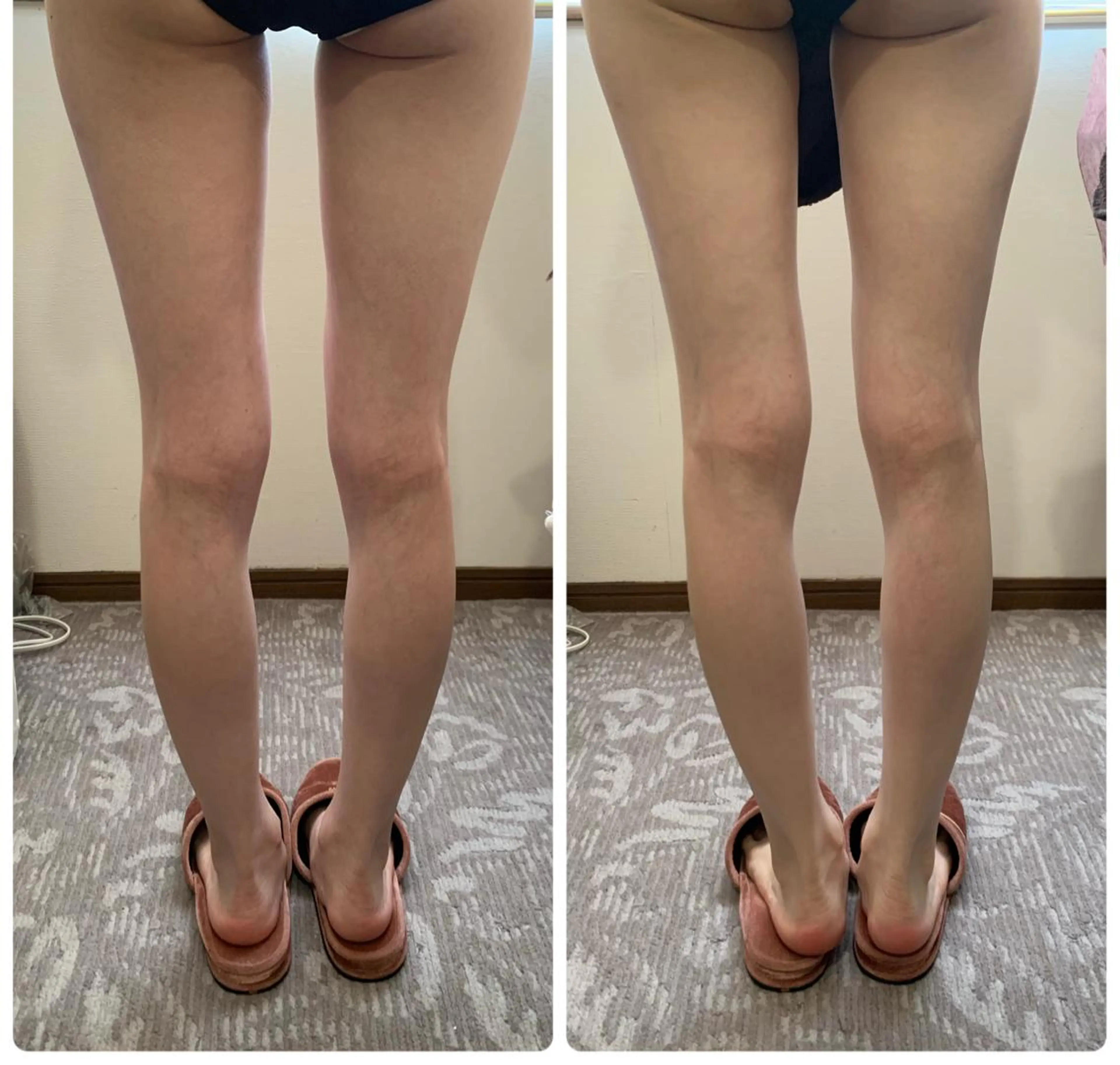 エステ espoir エスポワールのエステ・リラクイメージ