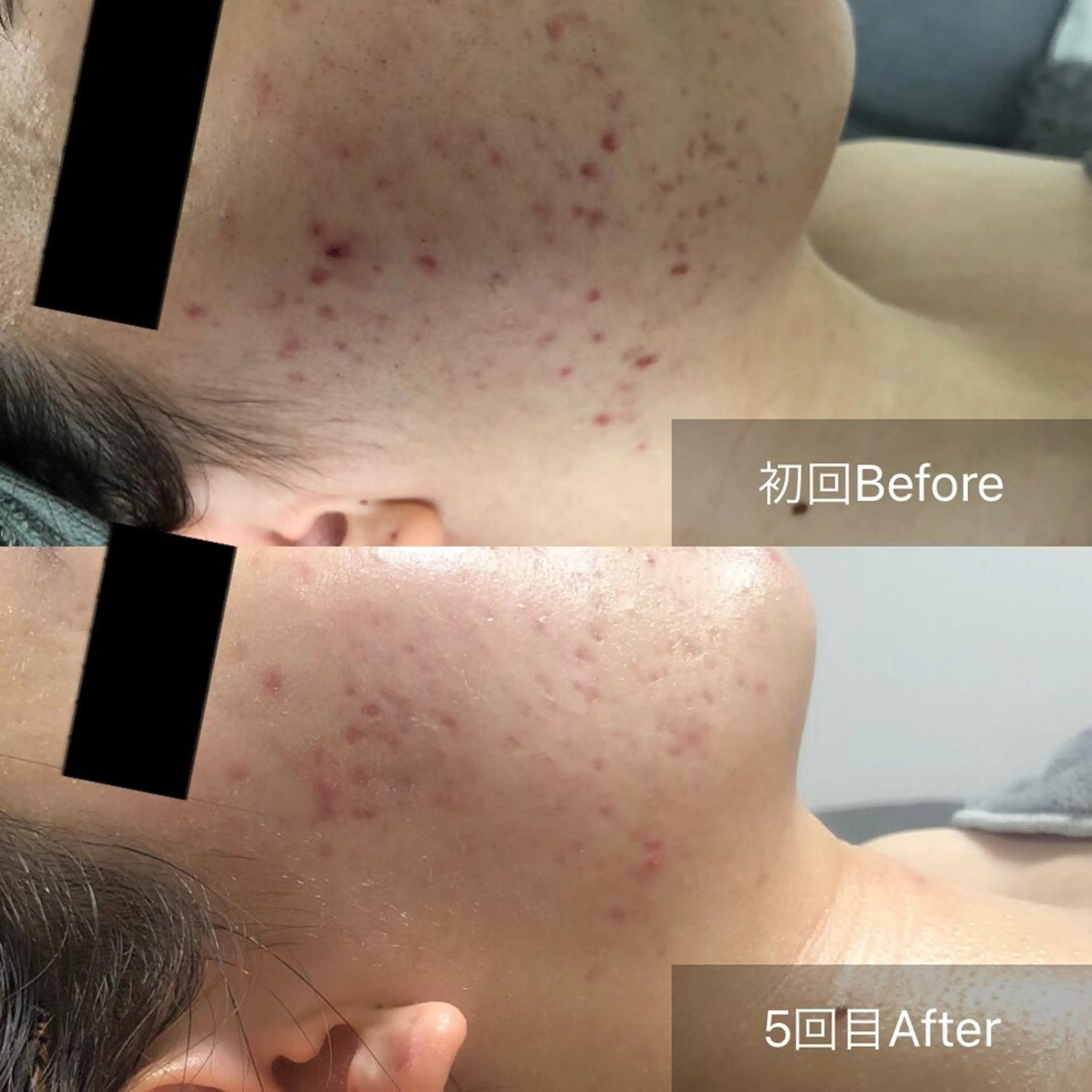 Radiance H.Oのエステ・リラクイメージ