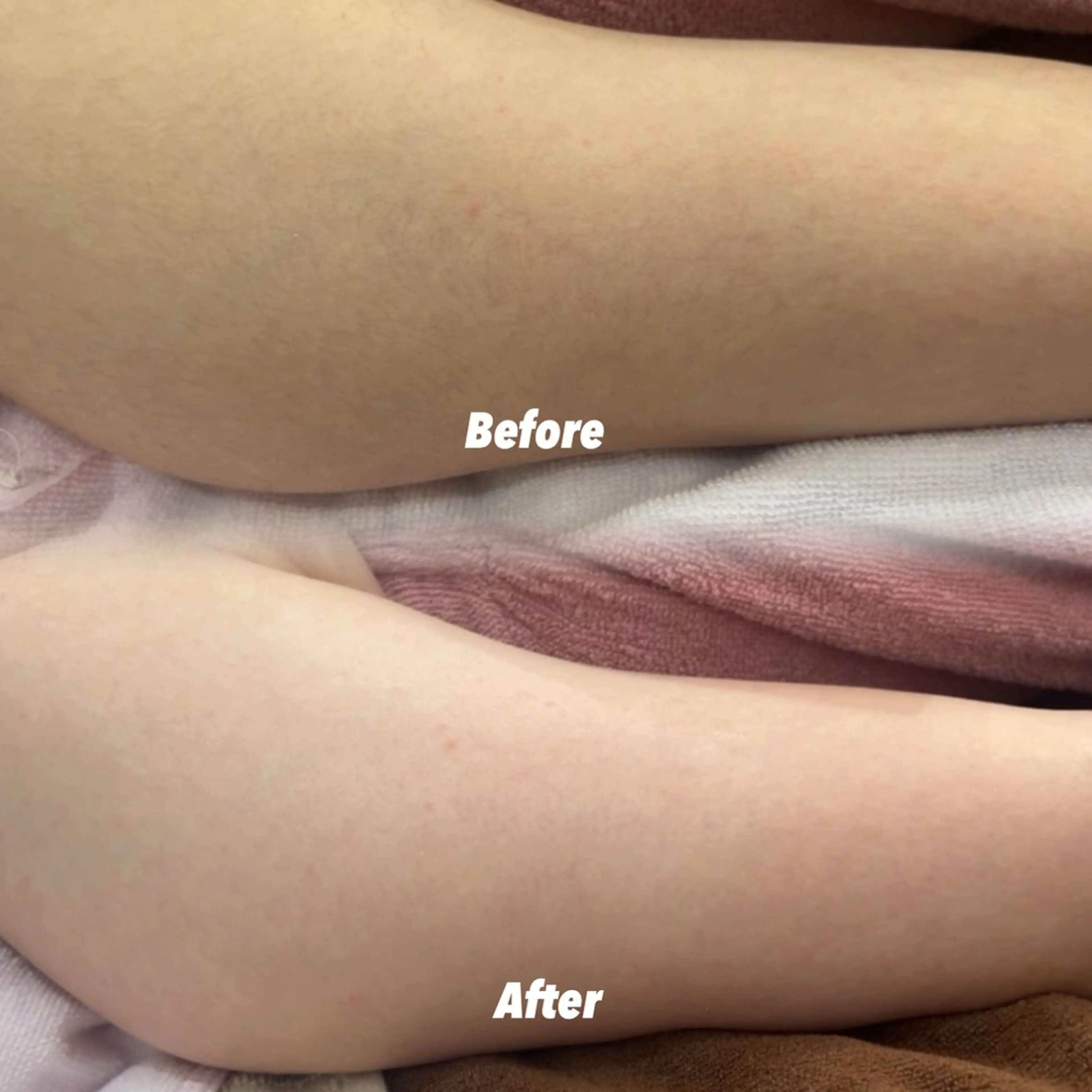 その他 🫧美しい素肌へ🫧 今成柚乃のその他イメージ