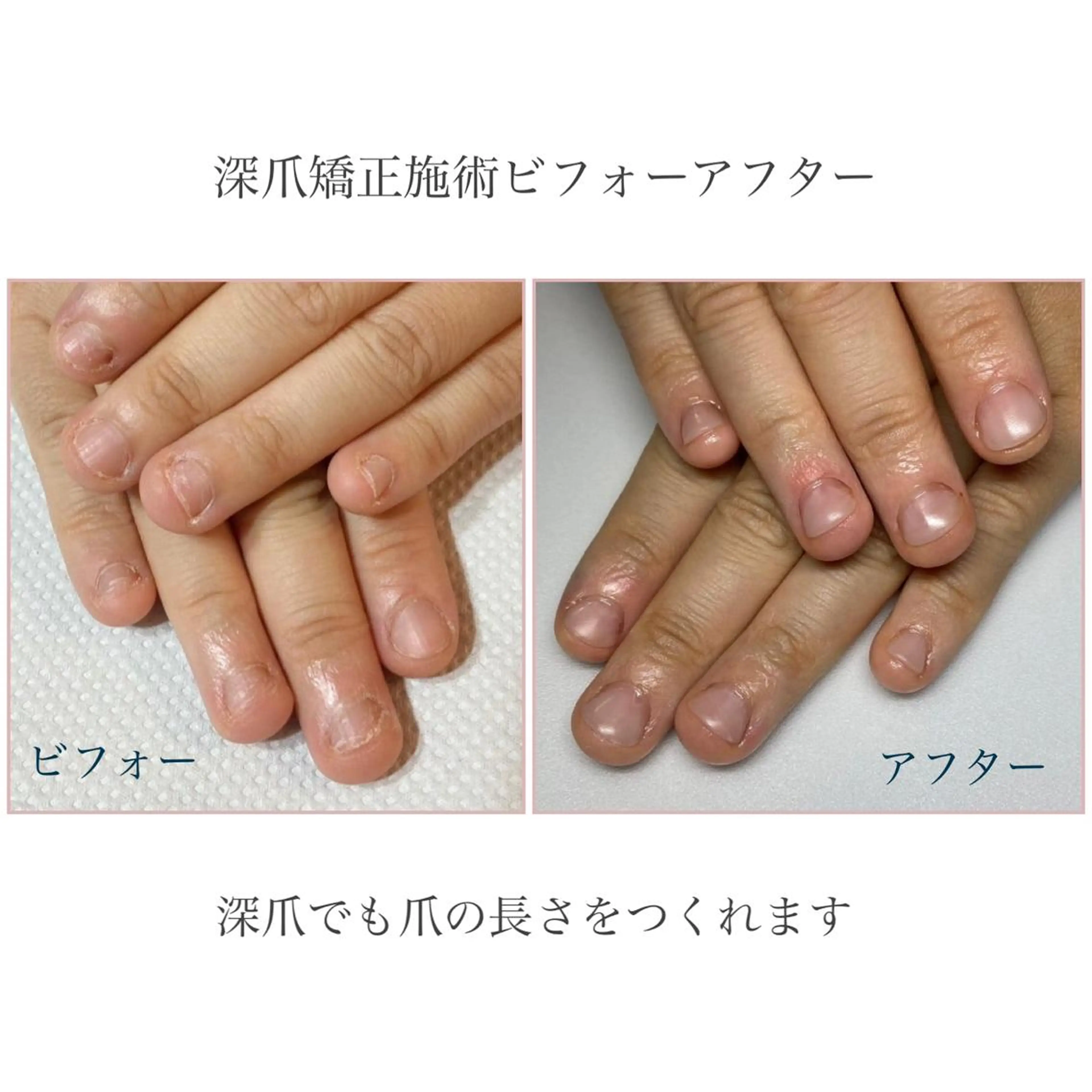 ネイル ネイルサロン アリュームのネイルデザイン