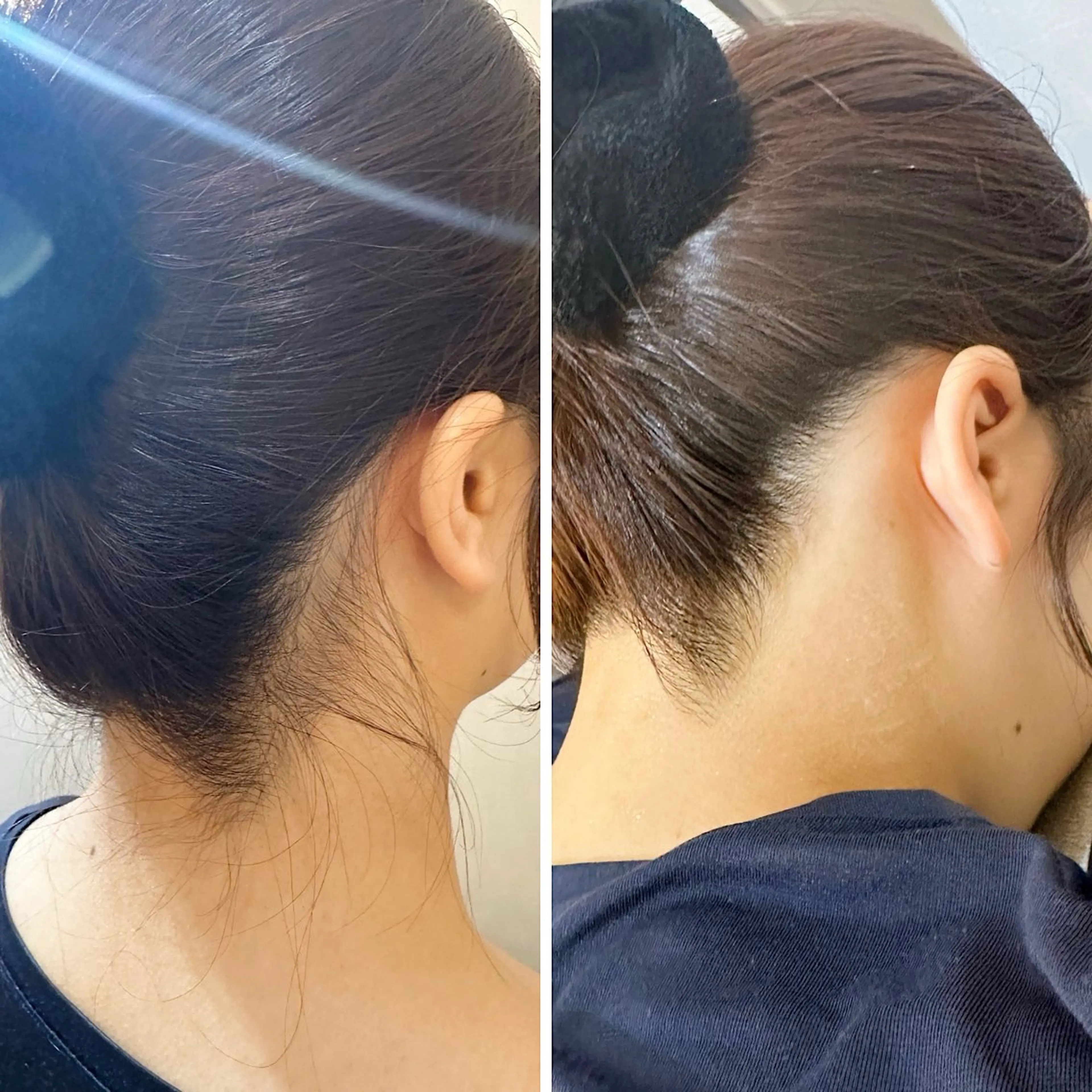 うなじ脱毛/美肌脱毛 LABELのエステ・リラクイメージ