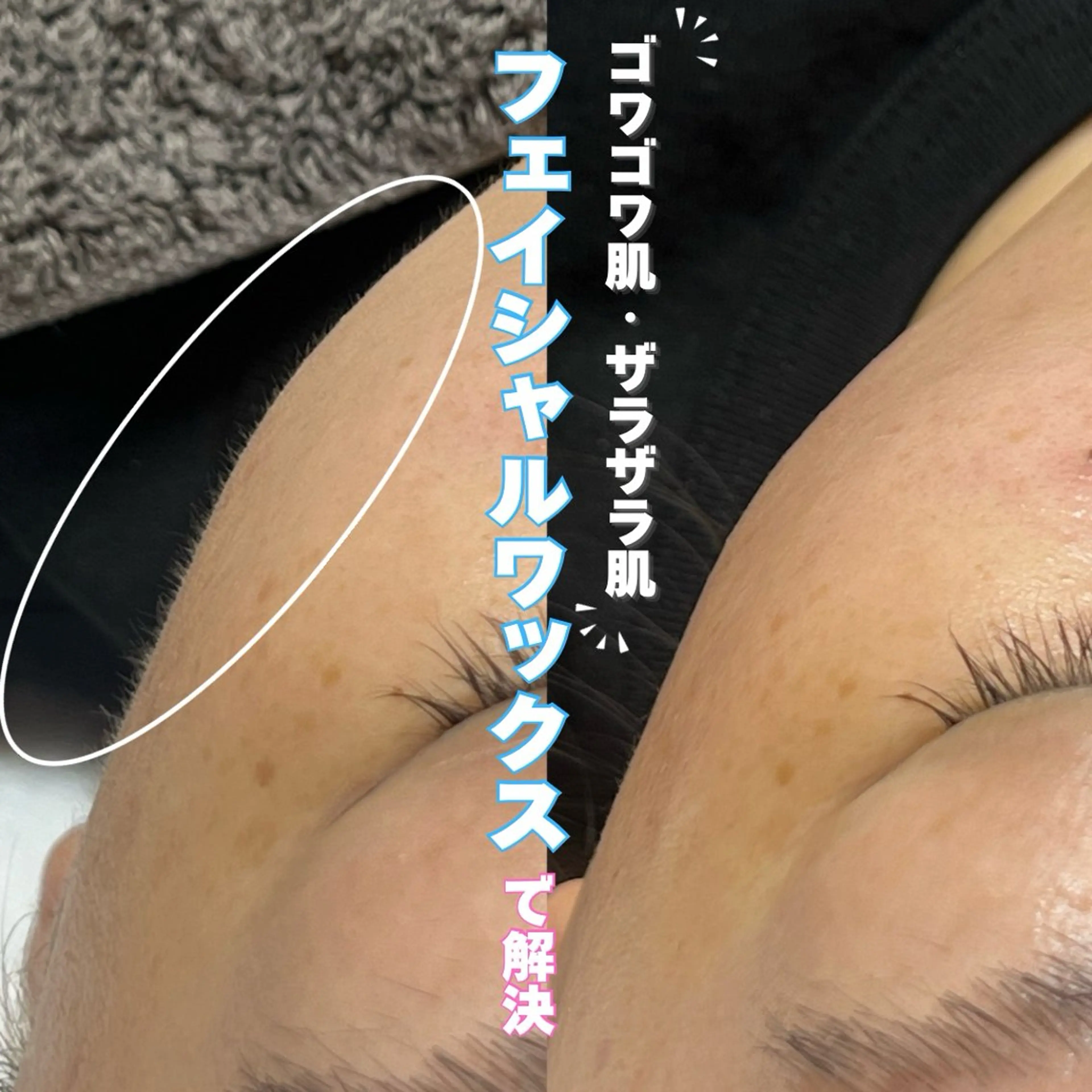 土日限定特別価格🤍全顔フェイシャルワックス🧏🏻‍♀️✨メンズの方も利用可能◎の写真