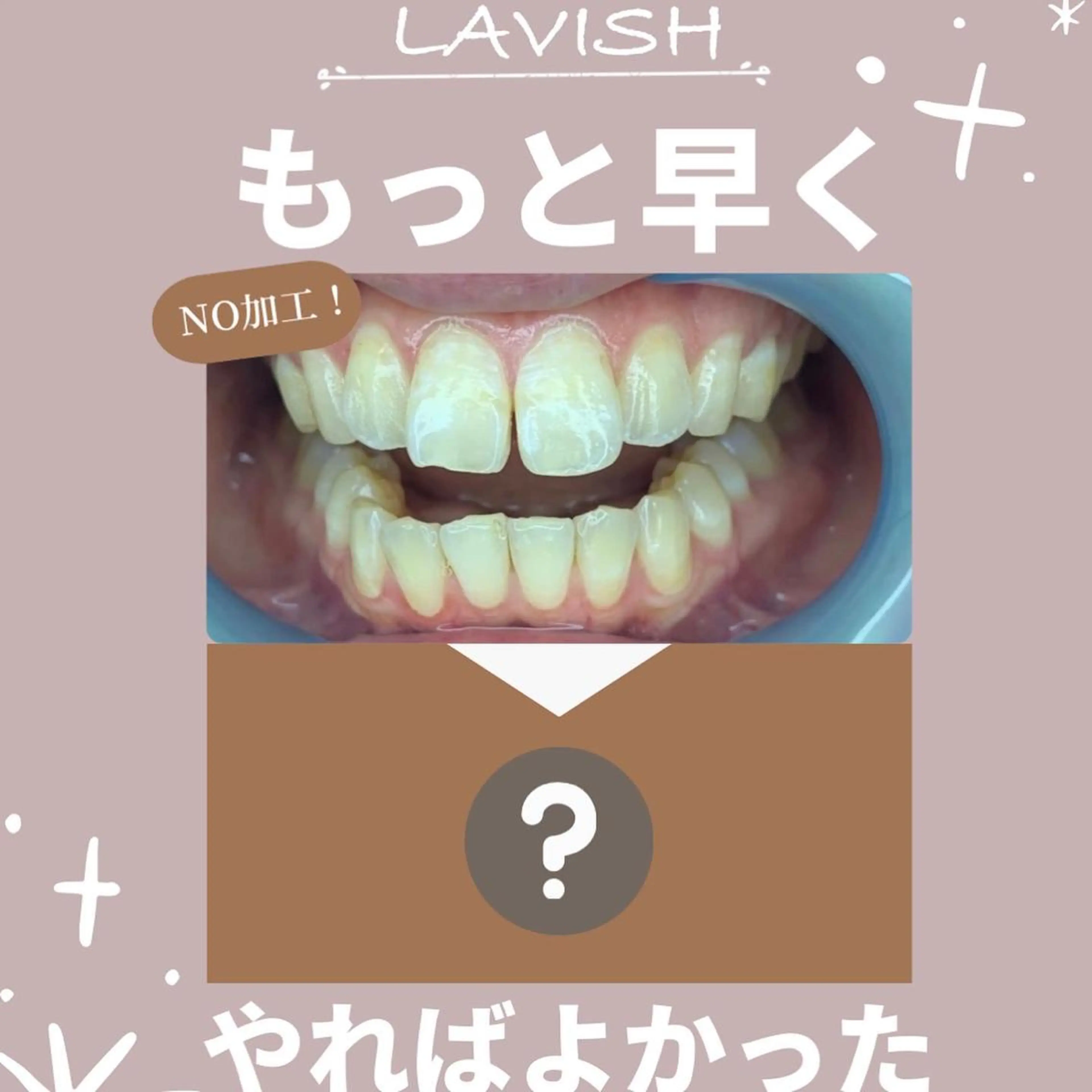 LAVISH nail salonのヘアスタイル