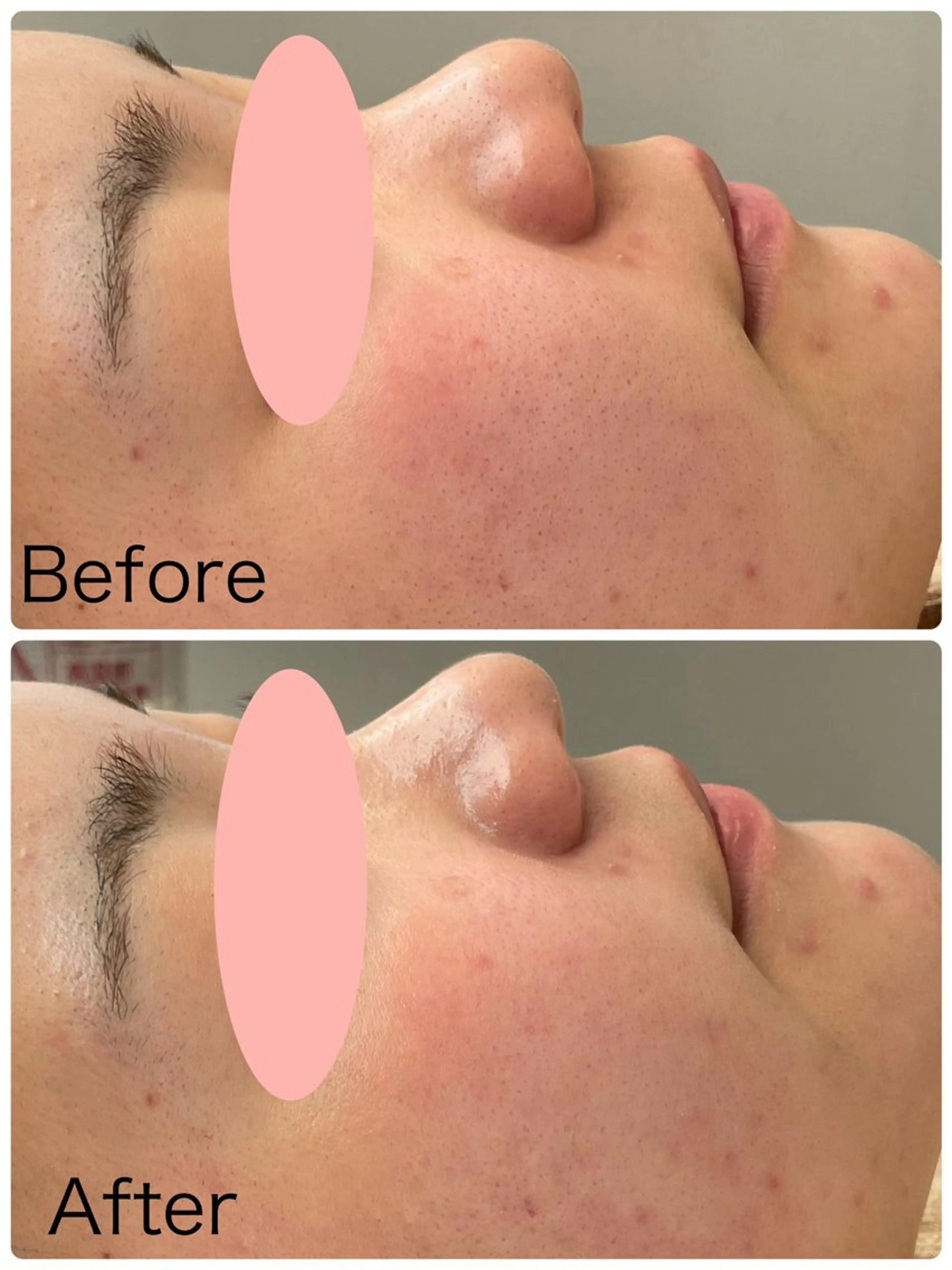 Loy（ロイ）🍀 ハーブピーリング🌈のエステ・リラクイメージ