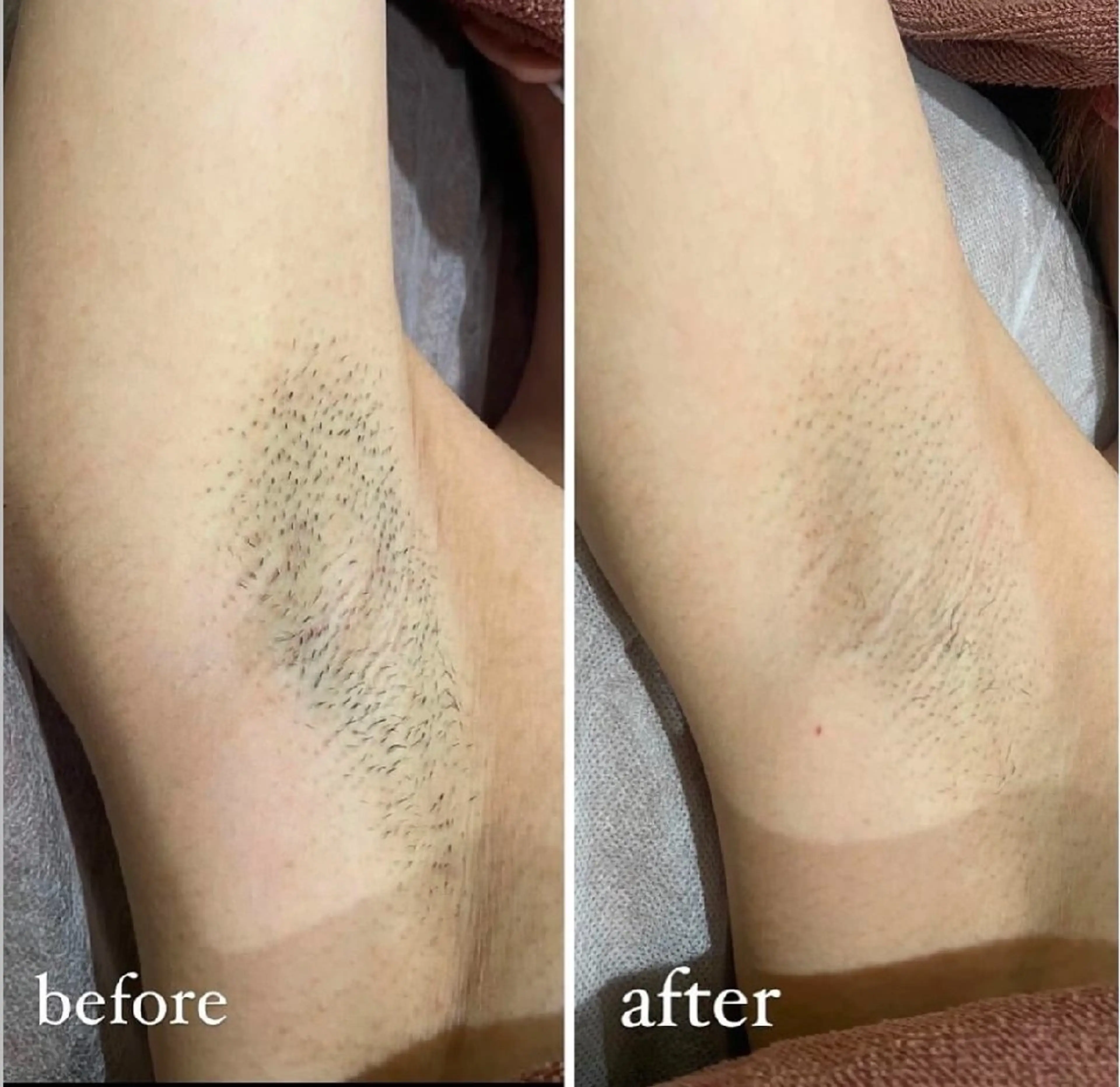 トータルビューティー 痩身&小顔専門店のエステ・リラクイメージ