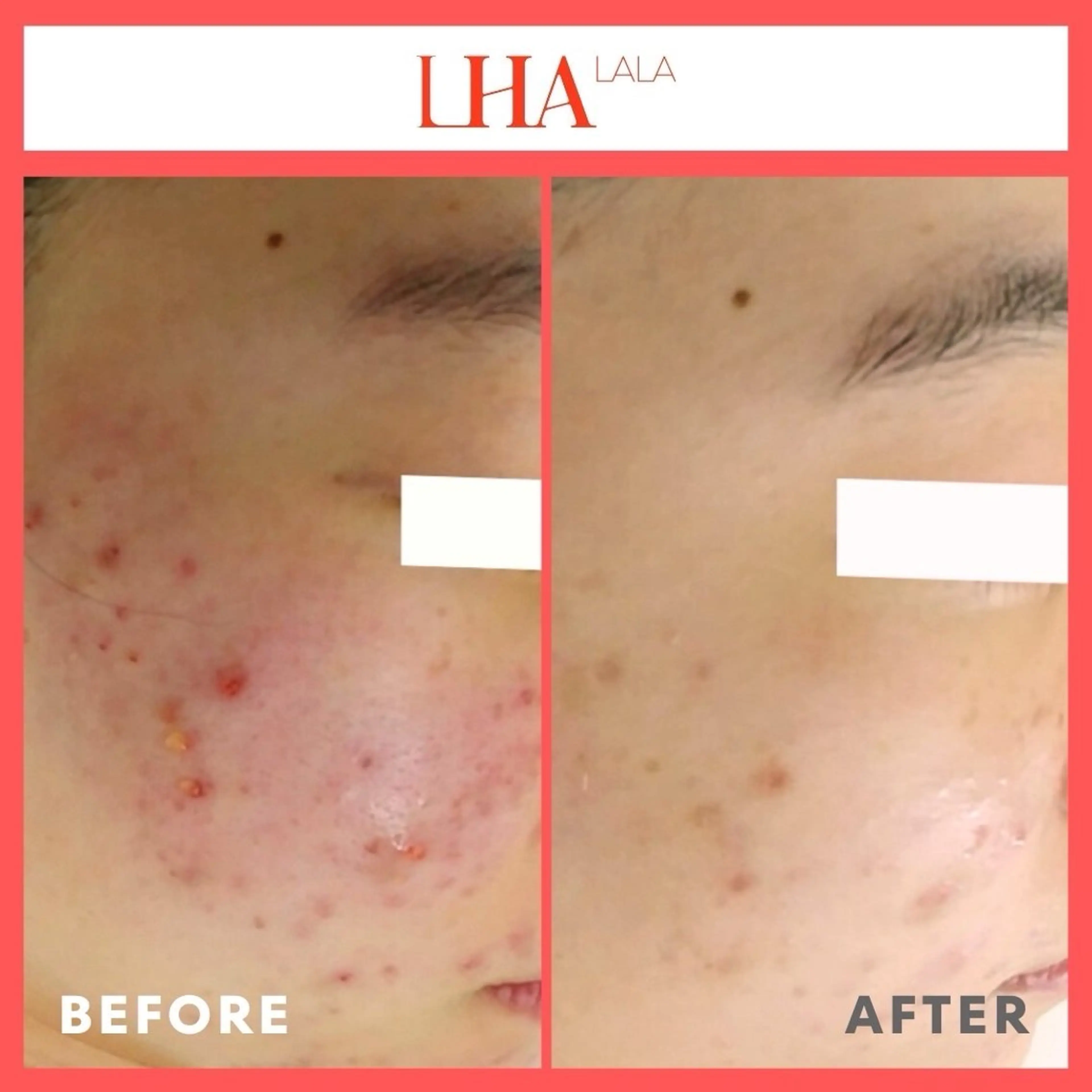 エステ VERY VERY 九条店のエステ・リラクイメージ