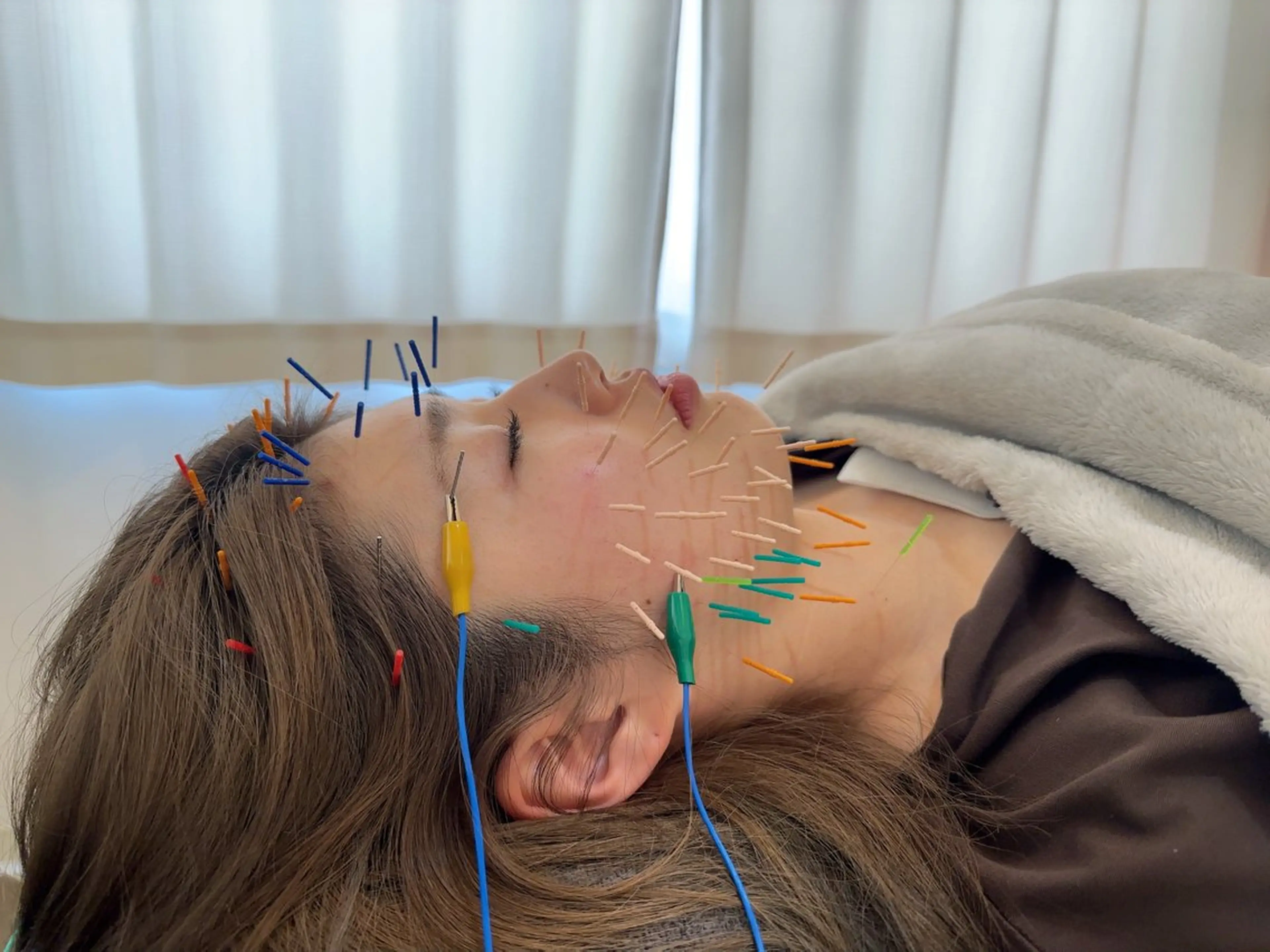 美容鍼＆鍼灸サロン 鍼Glitter.岡山駅前店所属・田中 美奈のエステ・リラクイメージ