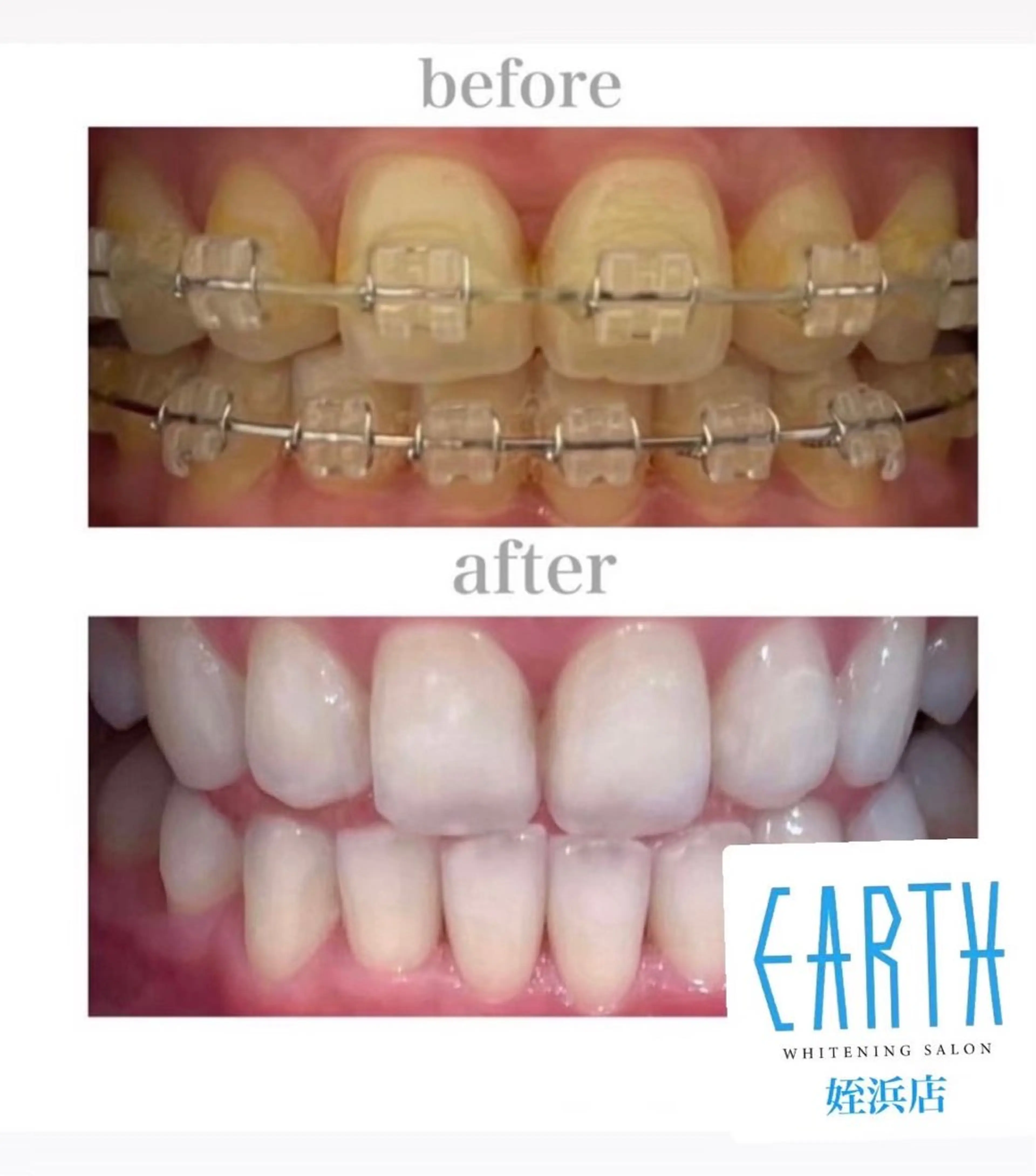 メンズ ホワイトニング ショップ福岡姪浜店のその他イメージ