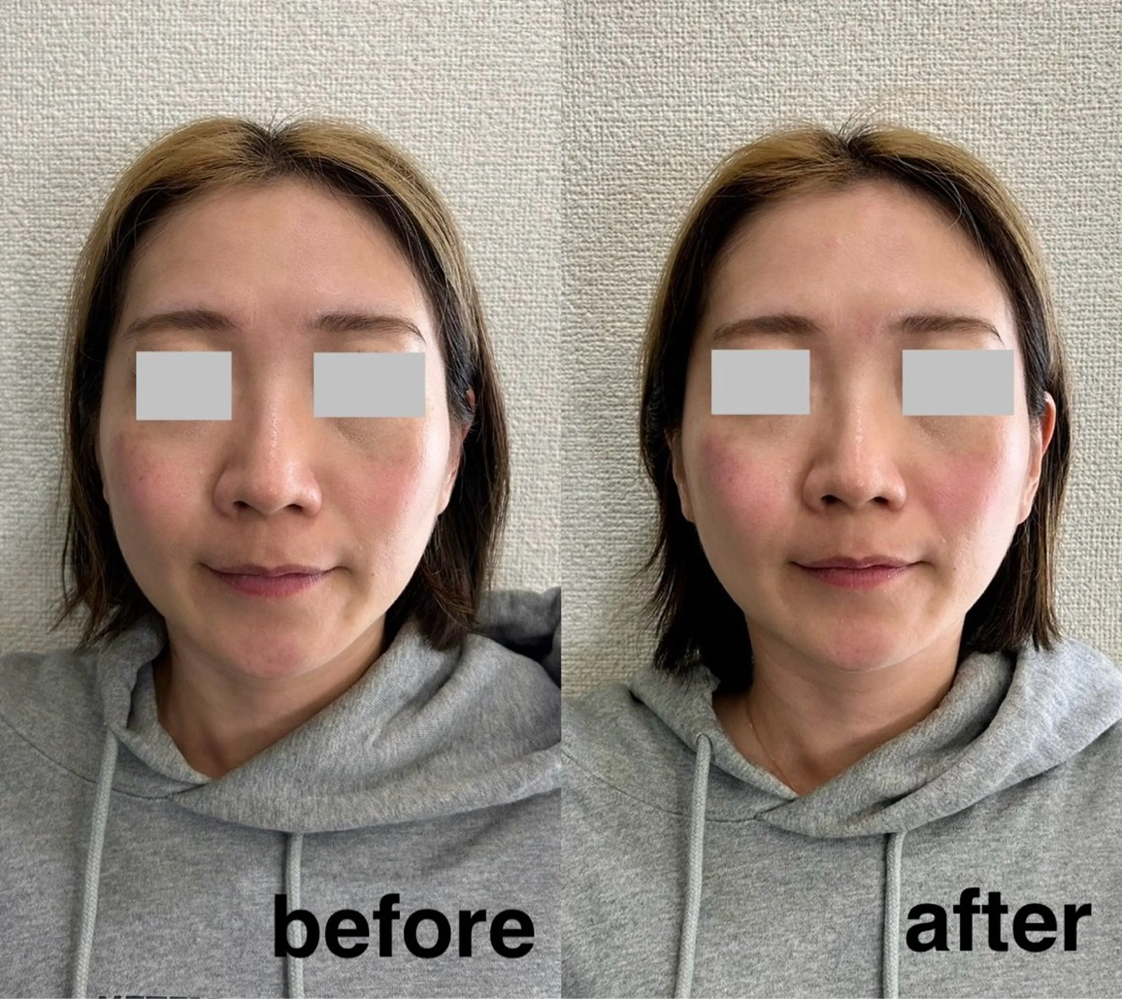 エステ Recellage リセラージュのエステ・リラクイメージ