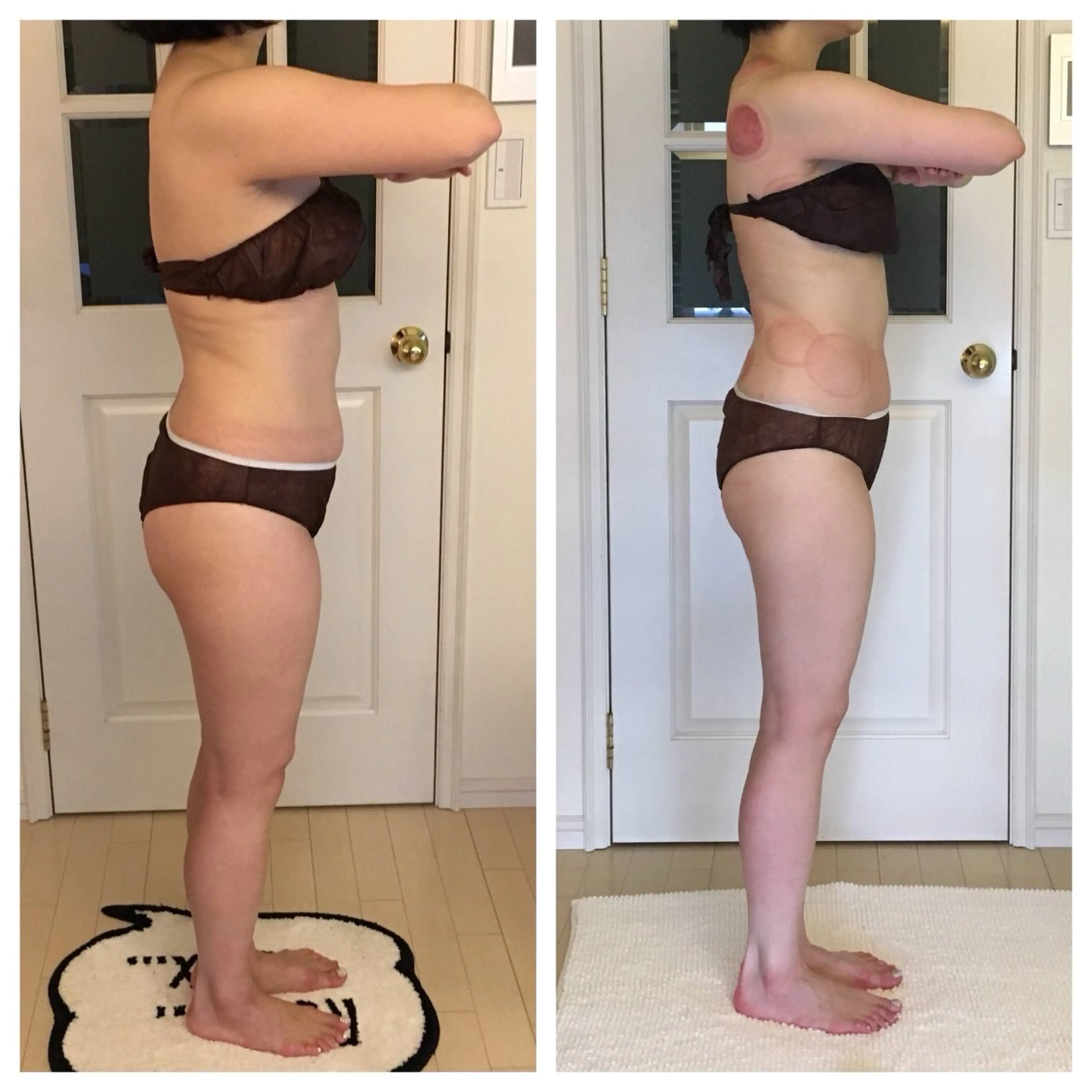 エステ リラク 超ド級痩身/ 肩こり撃退のエステ・リラクイメージ